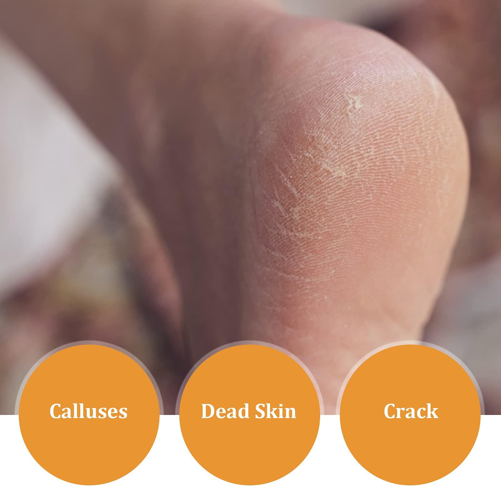 TITA-DONG TITA-DONG Foot Callus Remover, Double Sided Glass Foot Callus Remover, Dead Skin Keratin Pedicure Rough Skin Scrubber, Pedicure Foot Buffer for Soft Feet