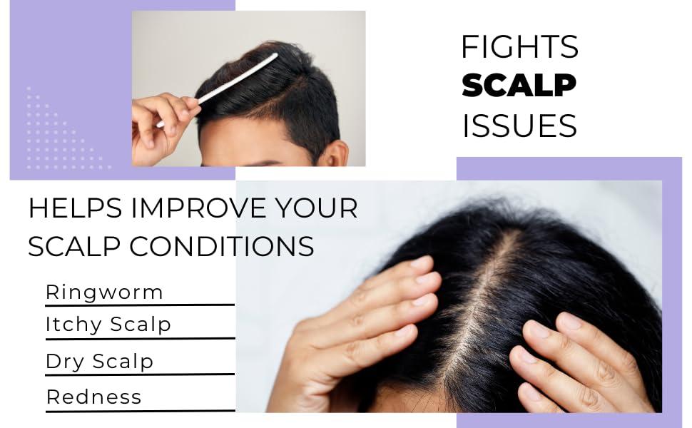 Healthy Hair Plus Fungus Shampoo & Conditioner Set for Humans - Relieves Itchy Dry Scalp, Reduces Inflammation & Irritation. Emu Oil for Gentle Cleansing, Non-Greasy for Women & Men. Made in the USA by Healthy Hair