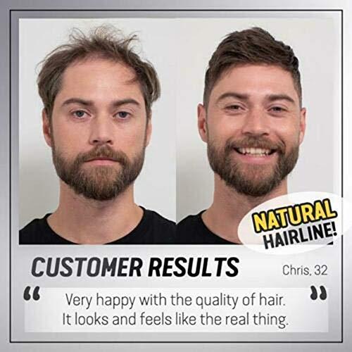 Qheng Qheng Bald Patch, Men Hair Topper Short Straight,Toupee Hairpiece Hair Extensions for Covering White Loss Hair for Men Women