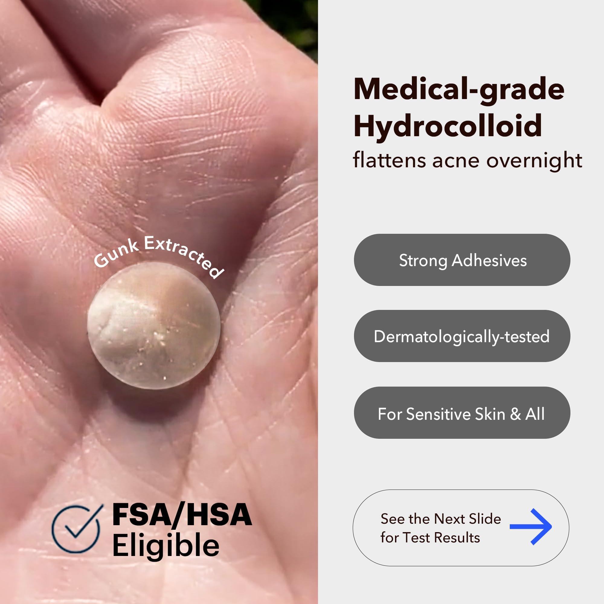 AVARELLE AVARELLE Acne Cover Patches, FSA HSA Eligible Hydrocolloid Pimple Patches for Face with Tea Tree Oil, Korean Skincare Zit Patches for Face | FSA HSA Store Eligible Items | Vegan, Cruelty-free