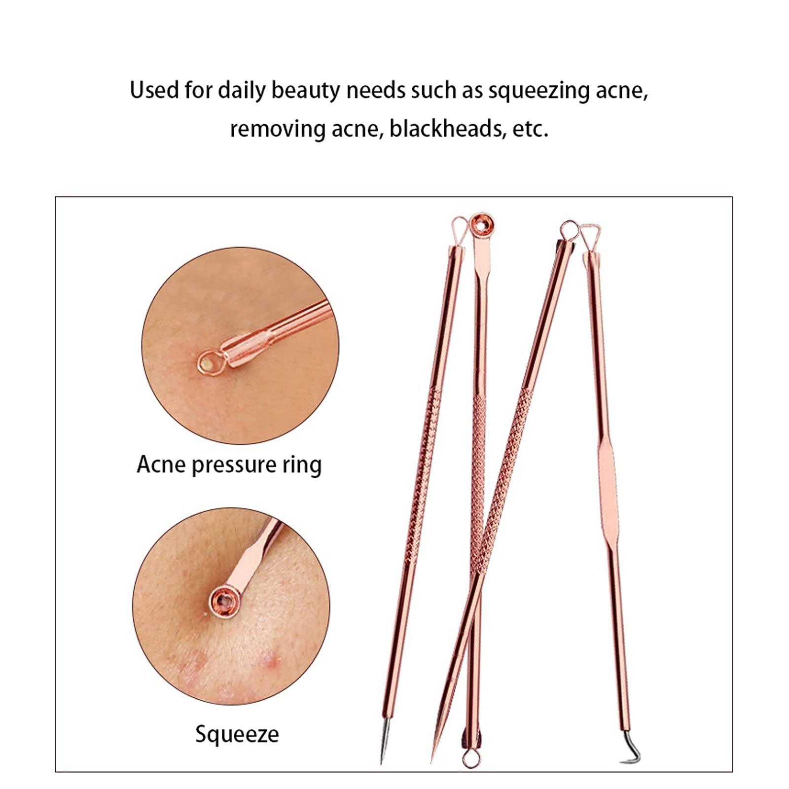 XINGTUO Pimple Popper Tool Kit 4 PCS Blackhead Remover Comedones Extractor Acne Removal Kit for Blemish, Zit Removing for Nose Face Tools Blackhead Remover Tools(A)