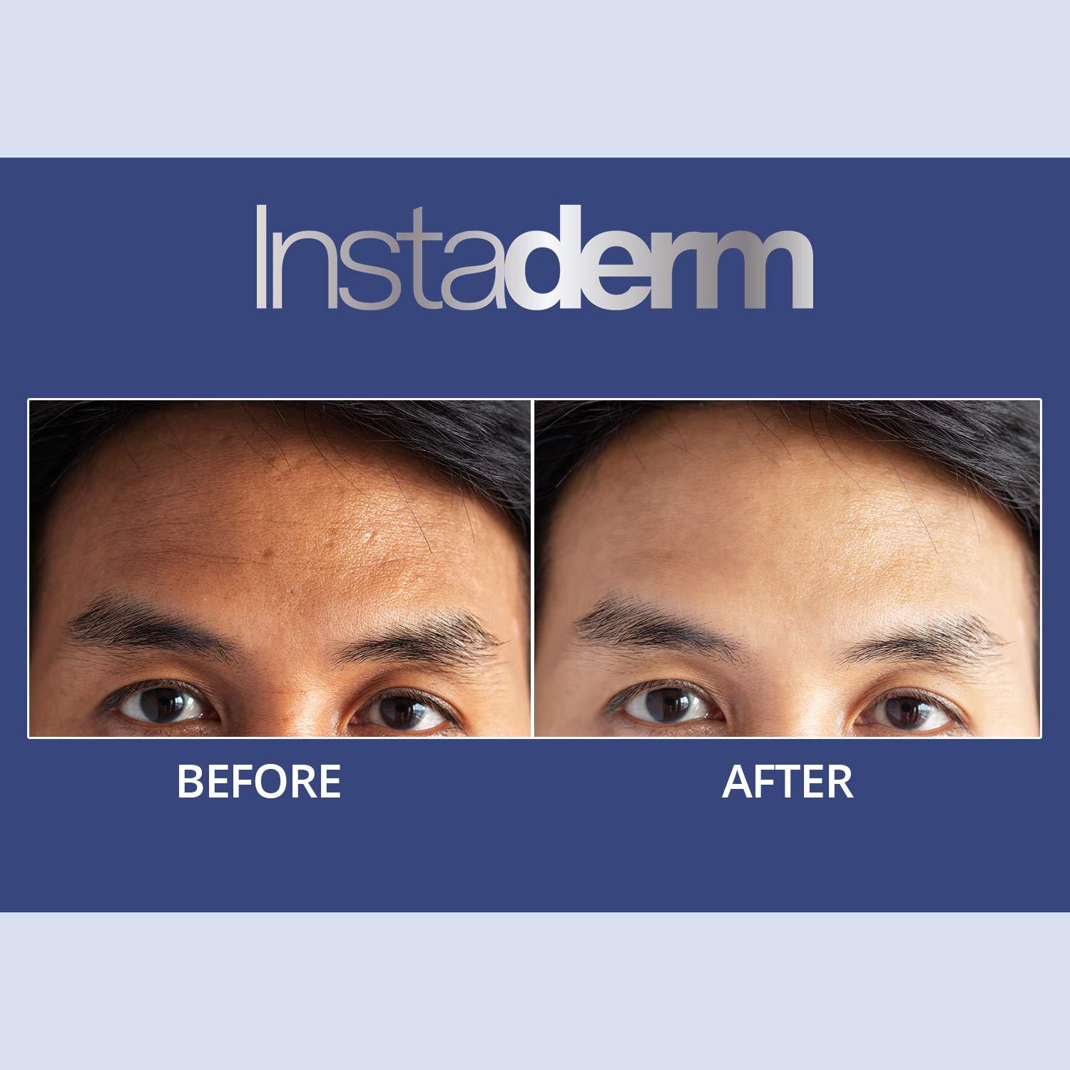 Instaderm Anti-Aging Exfoliating Peel Pads Smooths Fine Lines, Wrinkles, Dark Spots & Skin Roughness to Enhance the Skins Texture & Tone for Radiant Glow.