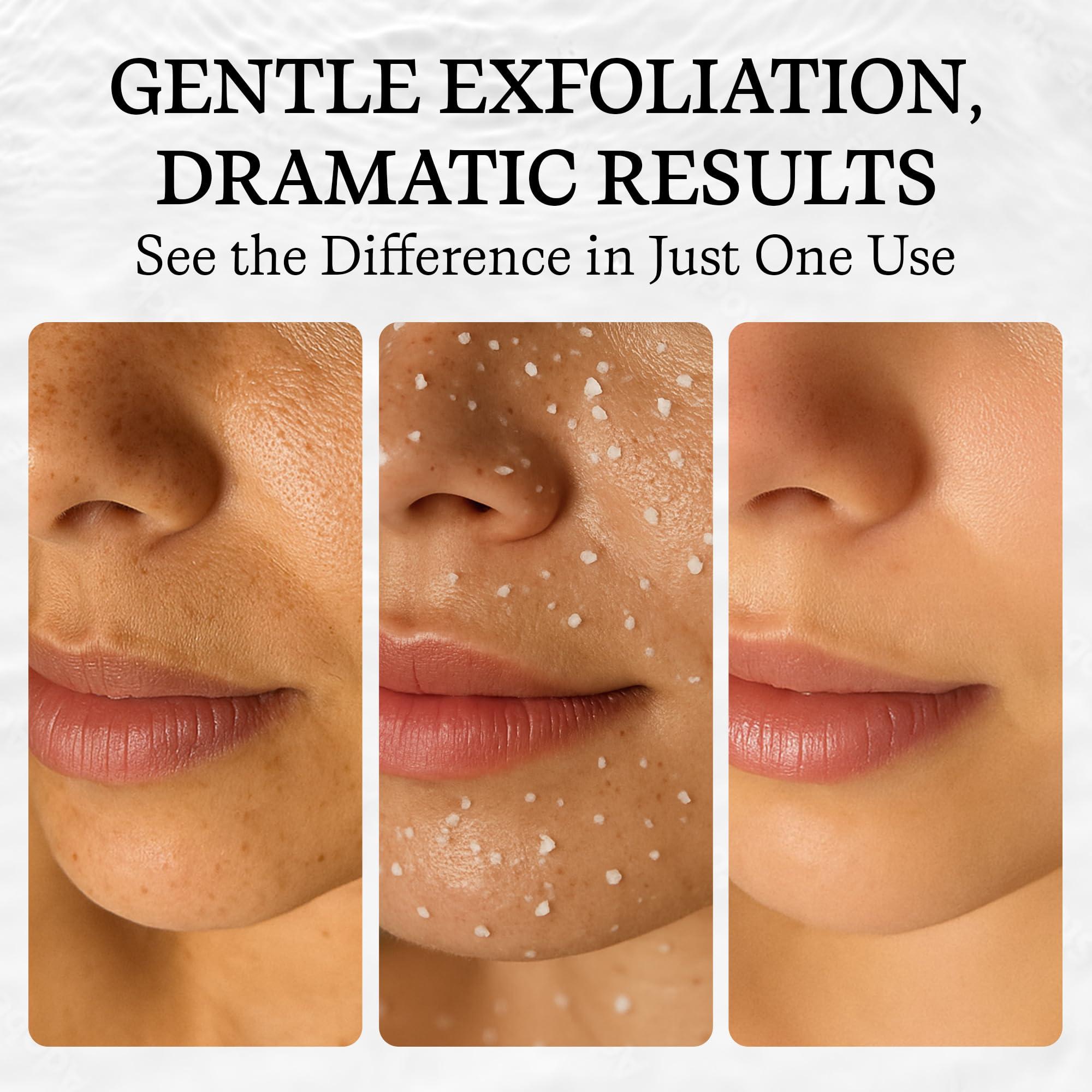 Vivo Per Lei Vivo Per Lei Facial Peeling Gel - Face Peel Containing Dead Sea Minerals and Nut Shell Powder - Exfoliating Gel And Blackhead Remover (Pack of 2) Includes 2 Travel Facial Peel tubes