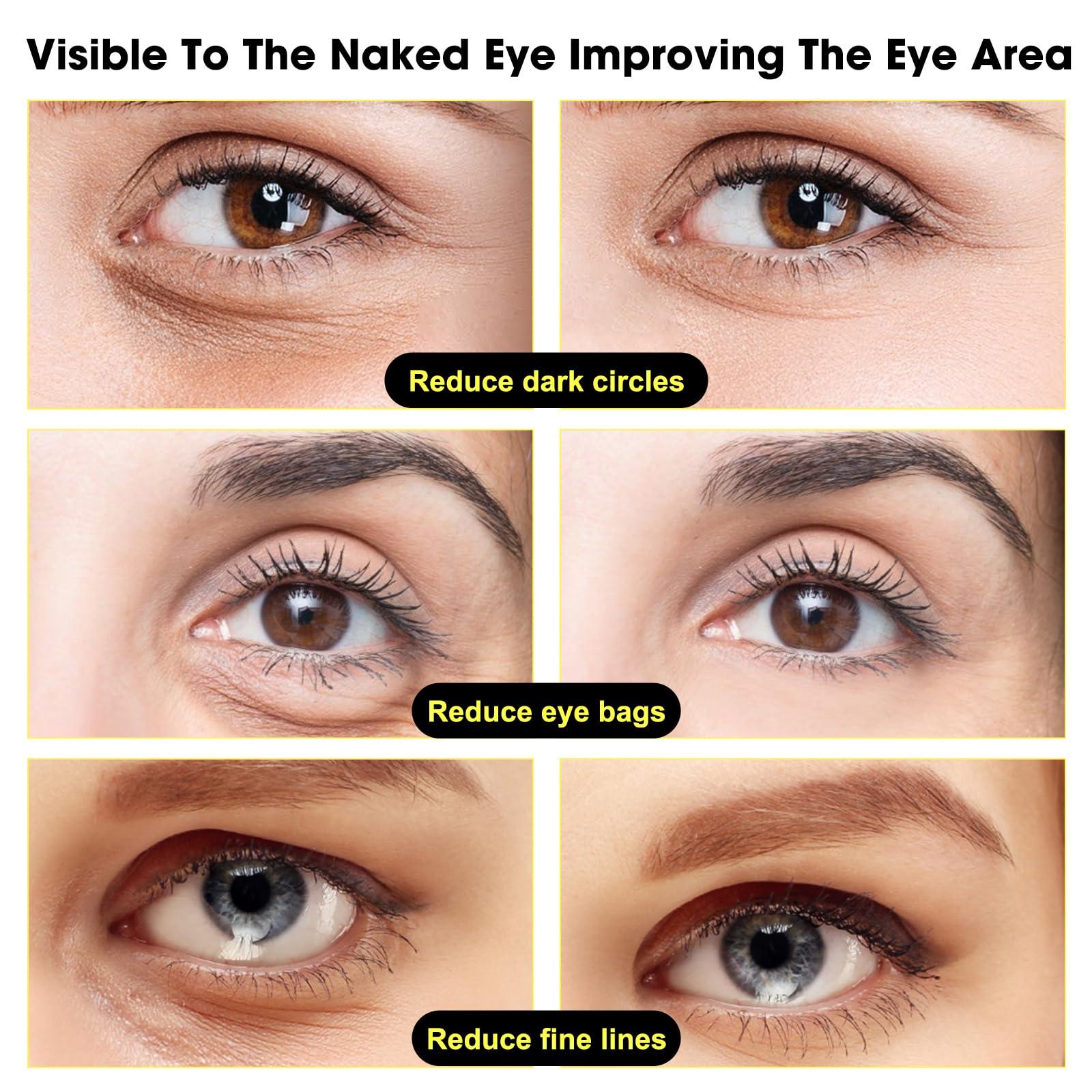 Kubot Harvey Ross Instant Lift Eye Cream, Harvey Ross effective Instant Eye Lift, Multi Action Firming Under Eye Cream, Under Eye Cream for Puffy Eye Bags Fine Lines, Specializes in Lifting The Eye Area