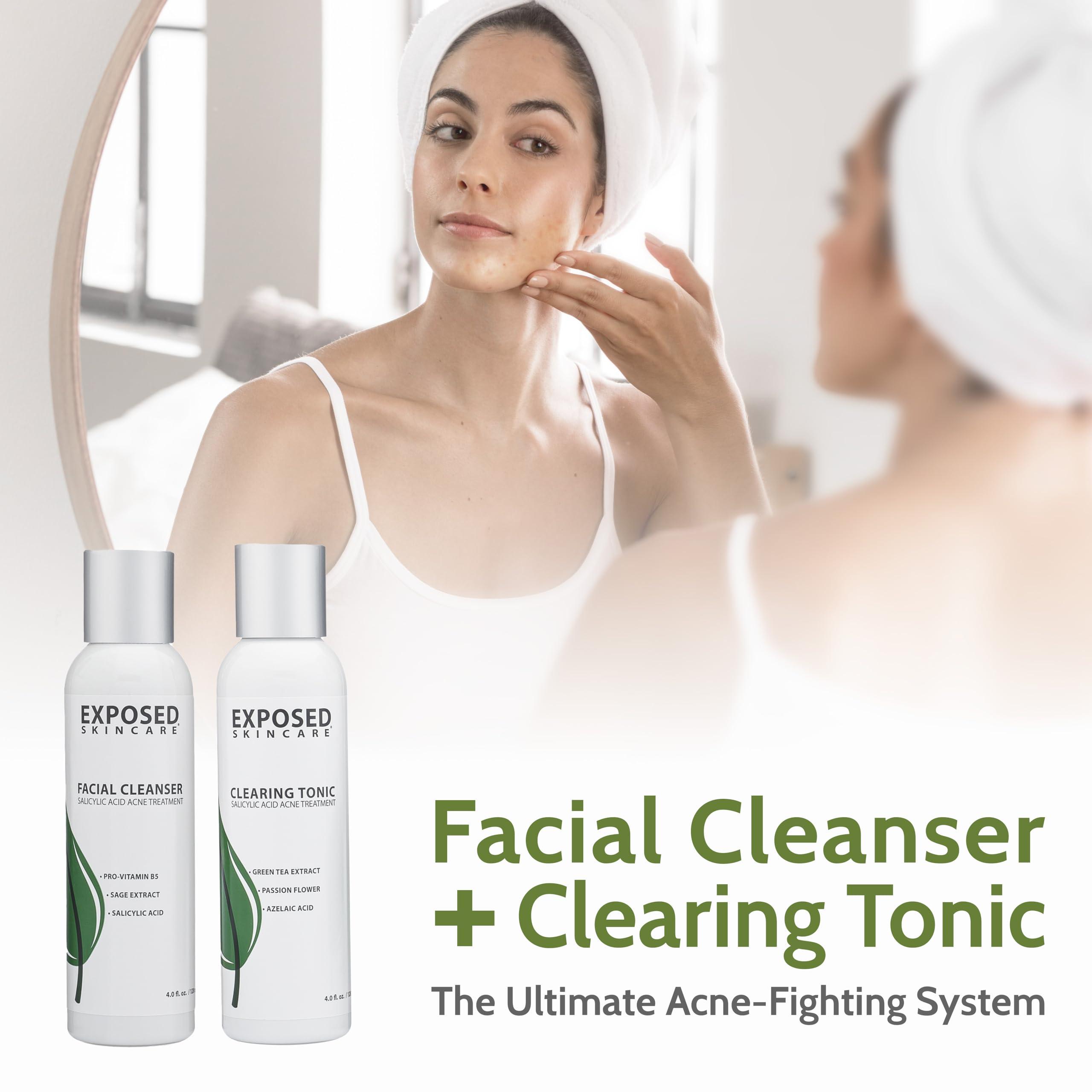 Exposed Skin Care Exposed Skin Care Expanded Acne Treatment Kit - Includes Salicylic Acid Face Wash, Clearing Tonic, Treatment Serum with Benzoyl Peroxide, Clear Pore Serum, Moisture Complex - Made for All Skin Types