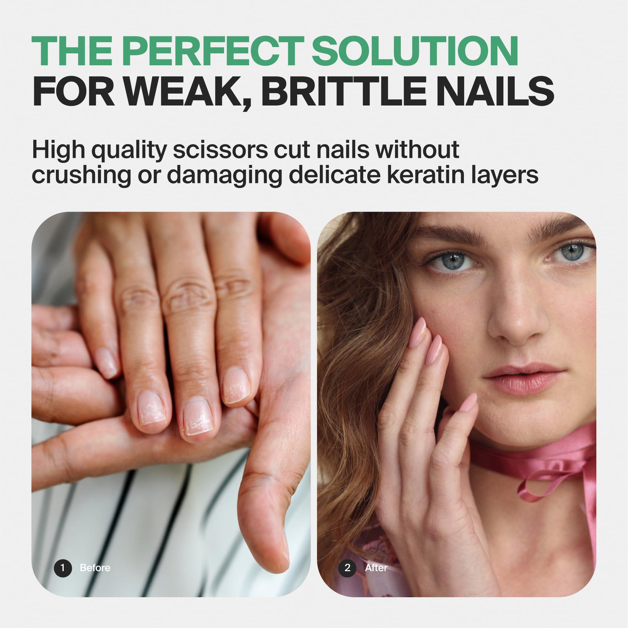 GERmanikure GERMANIKURE Professional Nail Cutter Scissors - Self-Sharpening FINOX22 Titanium Coated Stainless Steel Manicure Tools in Leather Case - Ethically Made in Solingen Germany - 2704