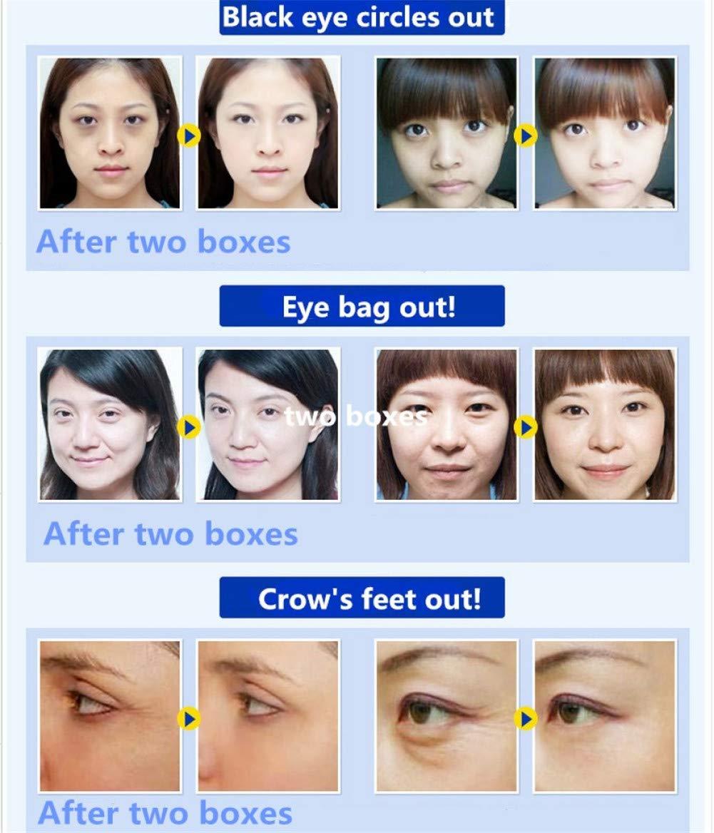 Adofect Adofect 30 Pairs Pink Eye Mask Collagen Eye Gel Pads Under Eye Patches Mask for Puffiness and Dark Circle Under Eye Patches for Women and Men