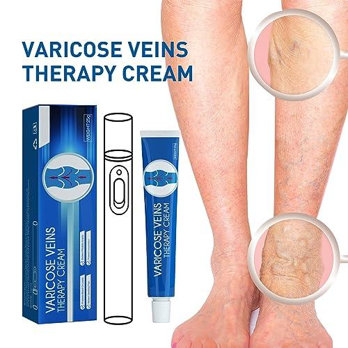 Nosbei Vericose Veins Treatment Blue Light Lazer Treatment Pen, Varicose Veins Blue Light Therapy Set, Blue Light Therapy Pen for Varicose and Spider Veins, Spider Vein Removal Lazer Pen (2cream+1pen)
