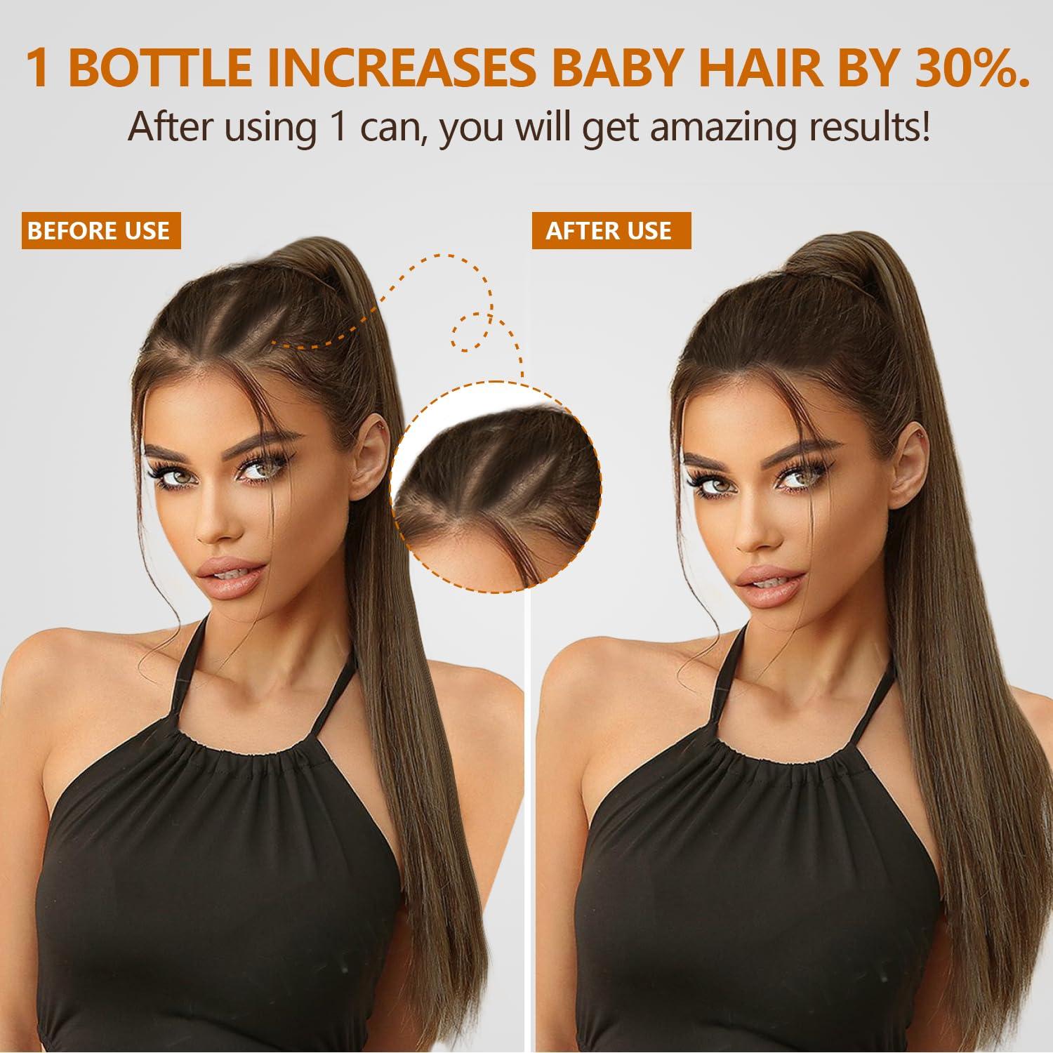 Samnyte Samnyte Dr Sebi Batana Oil For Hair Growth, Batana Oil Pure, Thickens Hair, Prevents Hair Loss For Men & Women - 4.23 Fl Oz