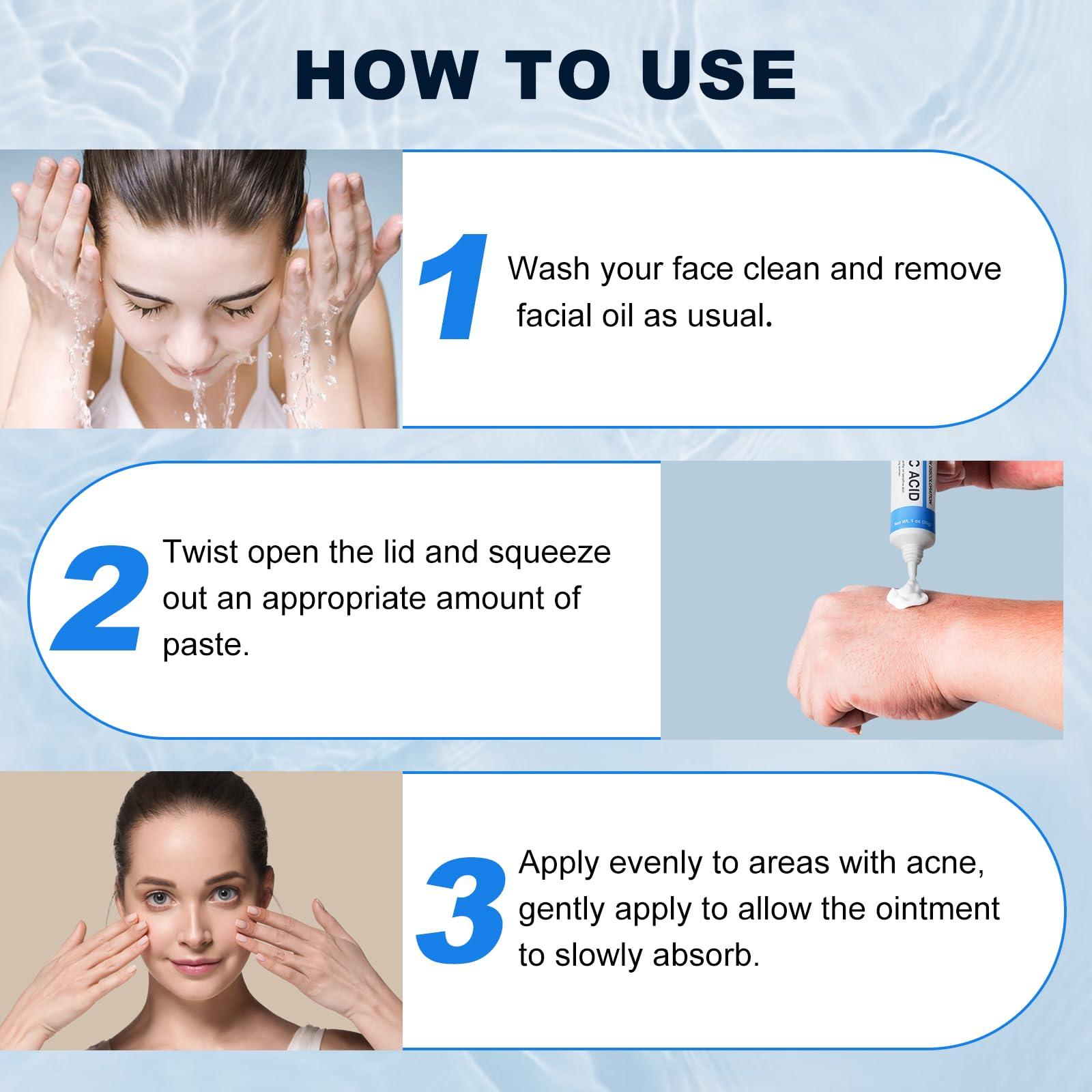 Netwik 10% Azelaic Acid Cream for Face - Acne Cream for Rosacea Reducing Relief Pimple Breakouts Blackhead Pigmentation and Redness - Azelaic Acid Gel For Facial and Skin Care