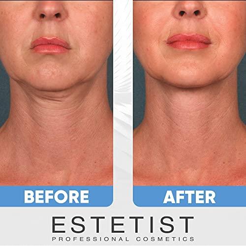 ESTETIST ESTETIST Caffeine Infused Coffee Eye Lift Cream And V Shaped Slimming Face Mask