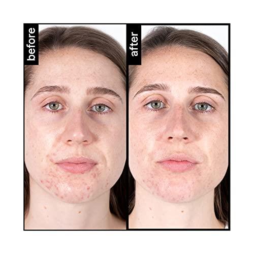 pH-In pH-In The Cleanser