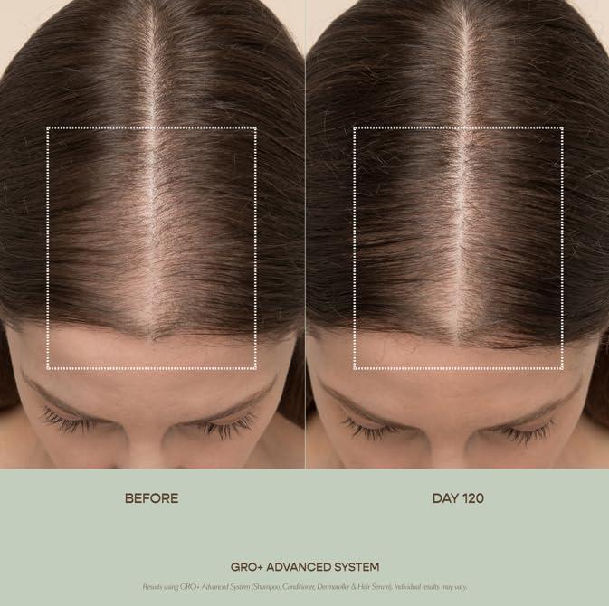VEGAMOUR VEGAMOUR GRO+ Advanced Hair Serum for Improving Hair Density, Reduces Shedding and Promotes a Healthy Scalp, 1 pack