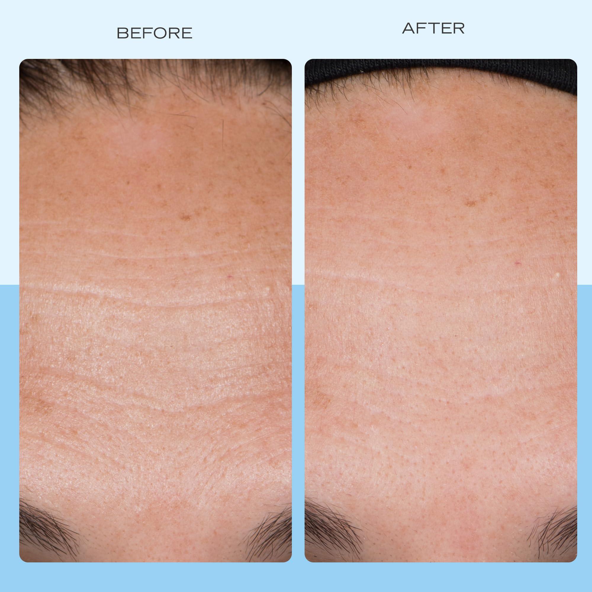 First Aid Beauty First Aid Beauty - Firming Collagen Cream with Peptides & Niacinamide, Ultra-Rich Plumping Moisturizer, Hydrates & Visibly Firms, Non-Comedogenic, Safe for Sensitive Skin, 3.5 oz