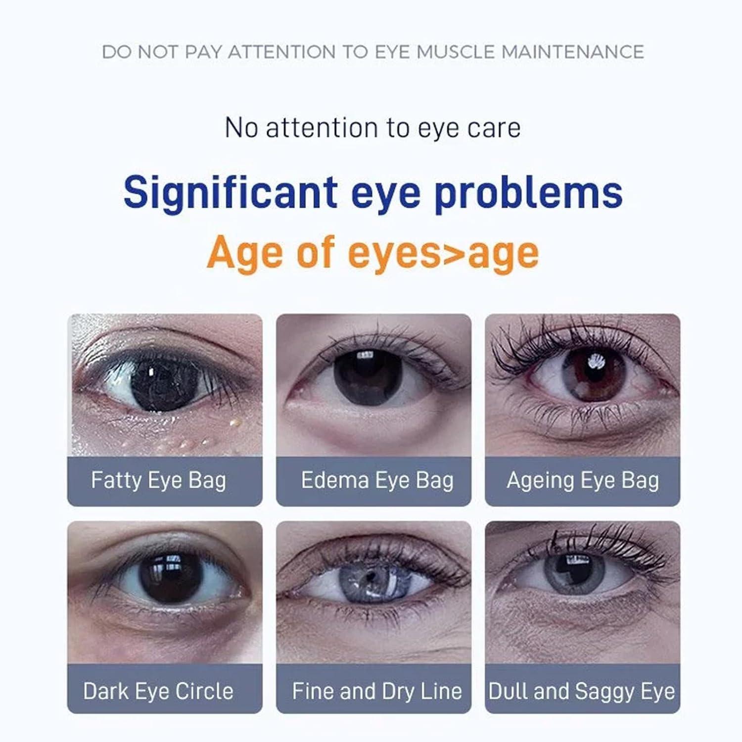 Qiuumey Qiuumey Eye Bag Removal Patch Japanese - Men Anti-Wrinkle Firming Eye Bag Patch Shuai Nan, Eye Bags and Dark Circles Firming Patch, Eye Bags Removal Branded Eye Bags Dark Circles Firming Patch