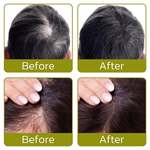 BIERDAN BIERDAN Fluff Up Secret Hair Fibers Powder,Hair Powder for Thinning Hair for Women,Hair Filler Powder for Men and Women,for Instantly Cover Sparse Hair,Hair Fiber Powder Waterproof