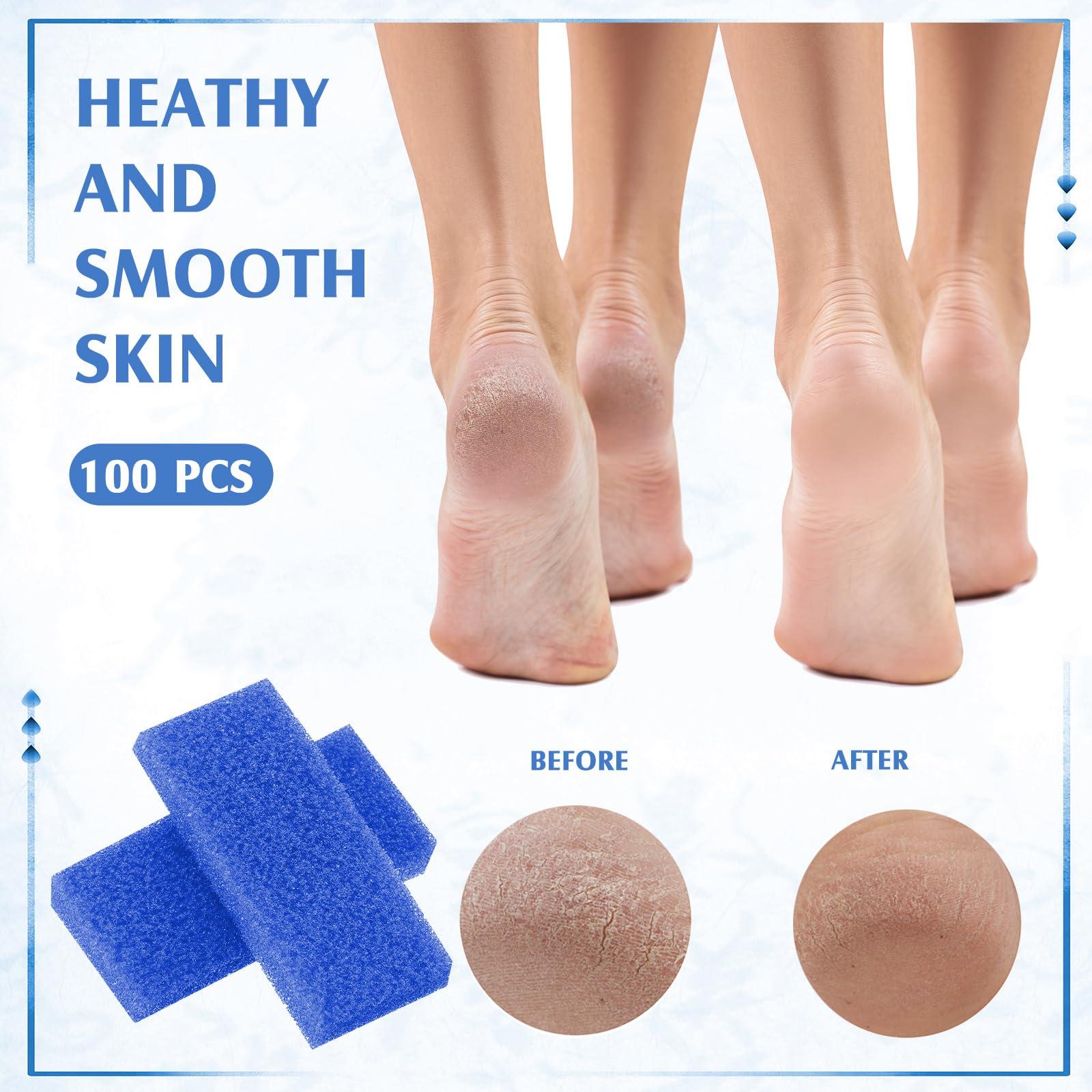 Batiyeer Batiyeer 100 Pcs Pumice Stone for Feet Scrubber Dead Skin Disposable Foot Pumice Foot Shower Scrubber Foot Scrubber for Heel Cuticle Callus Remover Bath Spa (Blue)