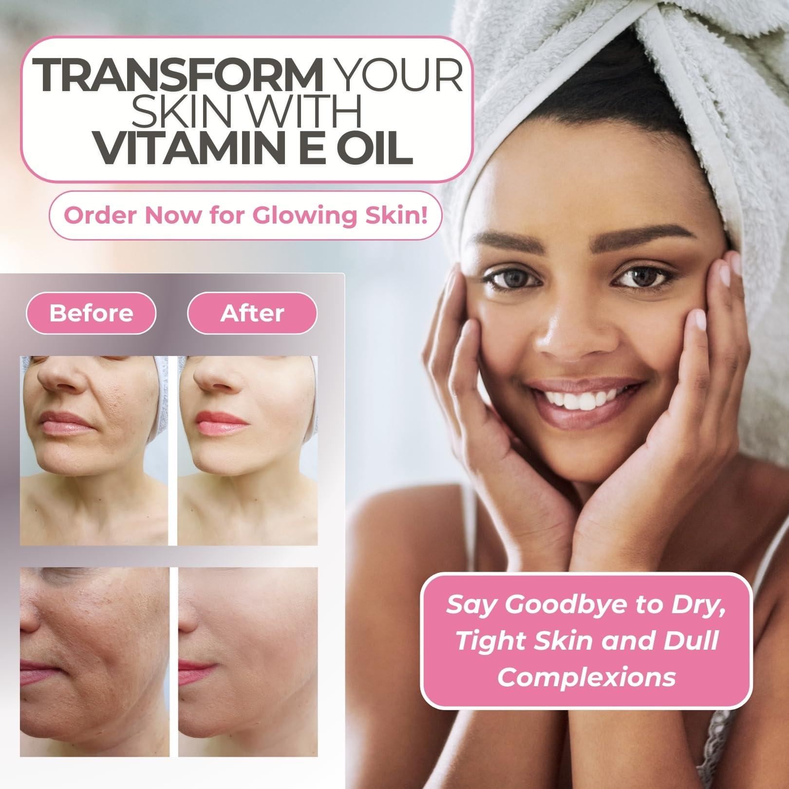 Leven Rose Vitamin E Oil by Leven Rose 75,000 IU per oz 100% Natural, Organic, Pure Vitamin E Oil for Skin, Face, Hair, Nails, and Scars, 4 oz