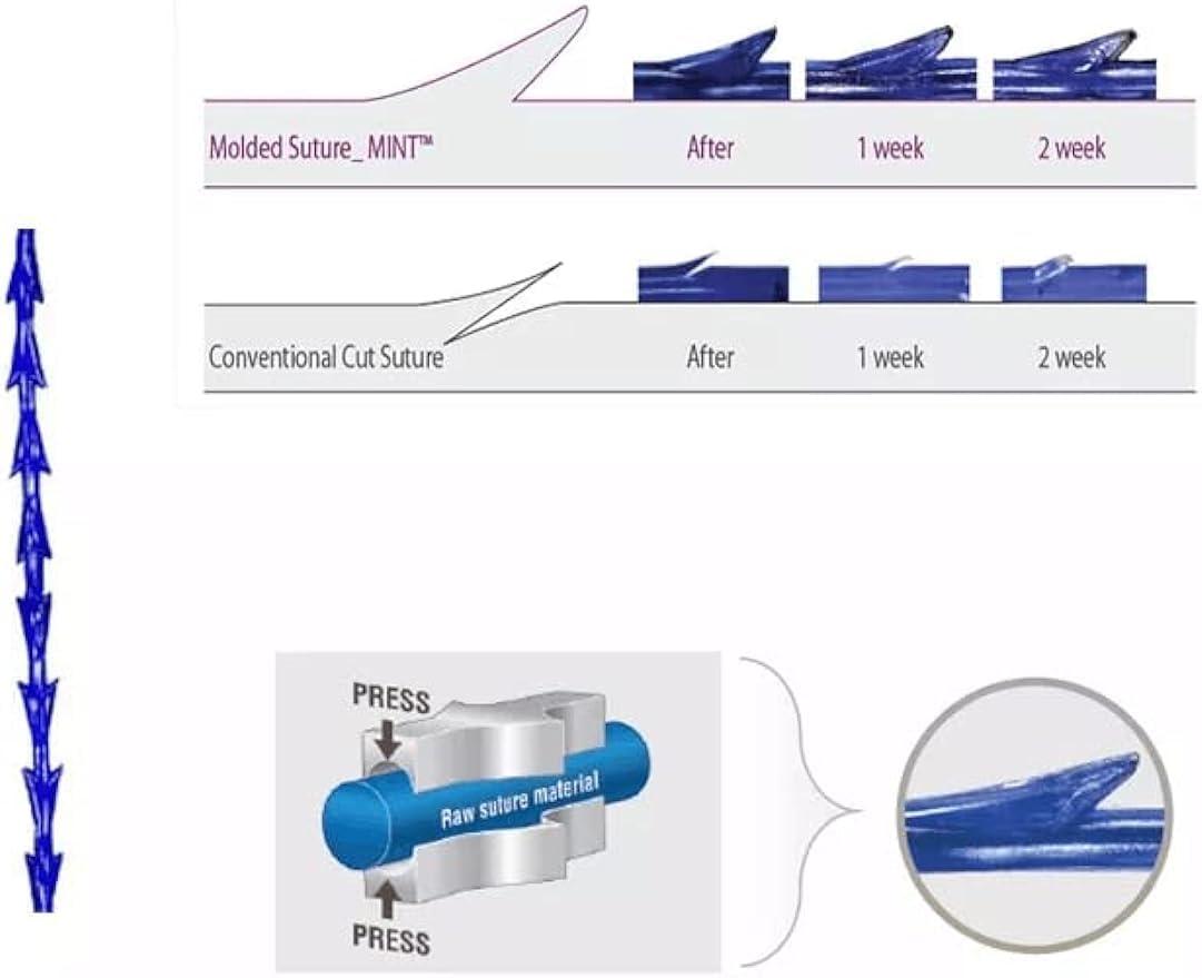 MatYas Pdo Pcl Fishbone Threads, Cog Threads 18G100mm, Barb Threads, W-Type Blunt, Lifting and Firming Anti-Aging, 20Pcs (PDO)