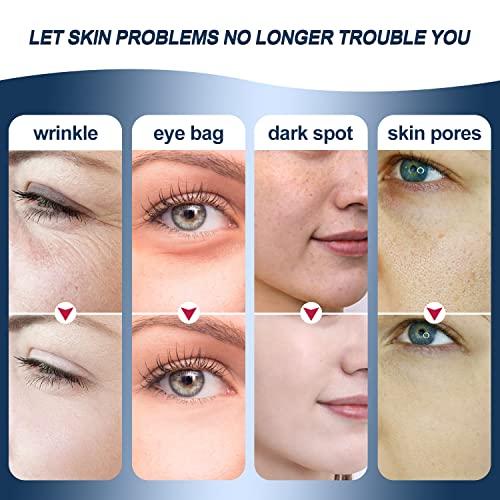 MiSMON MiSMON High Frequency Facial Machines, 4 in 1 Facial Massager Micro-Current Light Therapy Device for Face