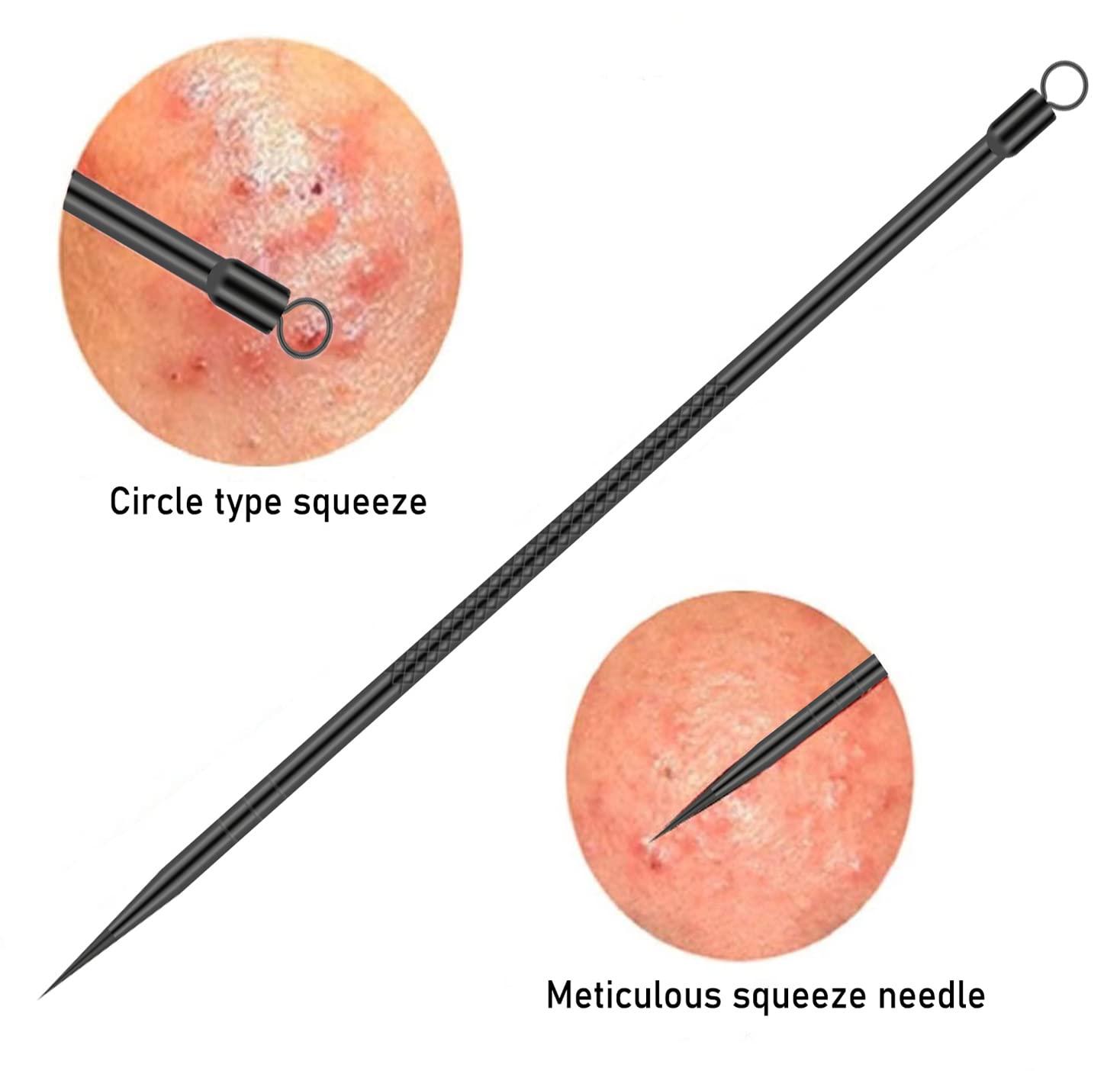 TULOBI Blackhead Remover Pimple Popper Tool Kit 4 Pcs Black Acne Comedone Zit Blackhead Extractor Tool for Nose Face,Stainless Steel Whitehead Popping Removal Tool Set