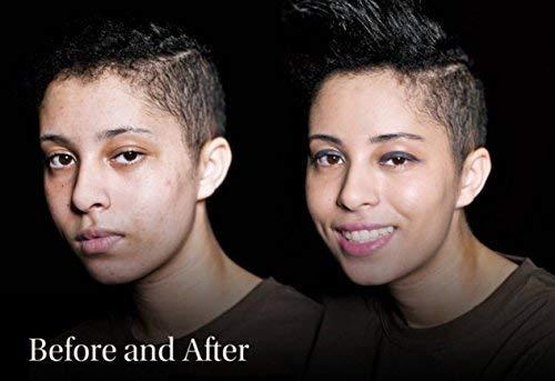 Keromask Keromask Full Coverage Concealer | Dark No 3 | Camouflage Makeup | Waterproof Concealer | Hypoallergenic | Vitiligo, Tattoo, Rosacea, Tattoo Cover |24 Shades