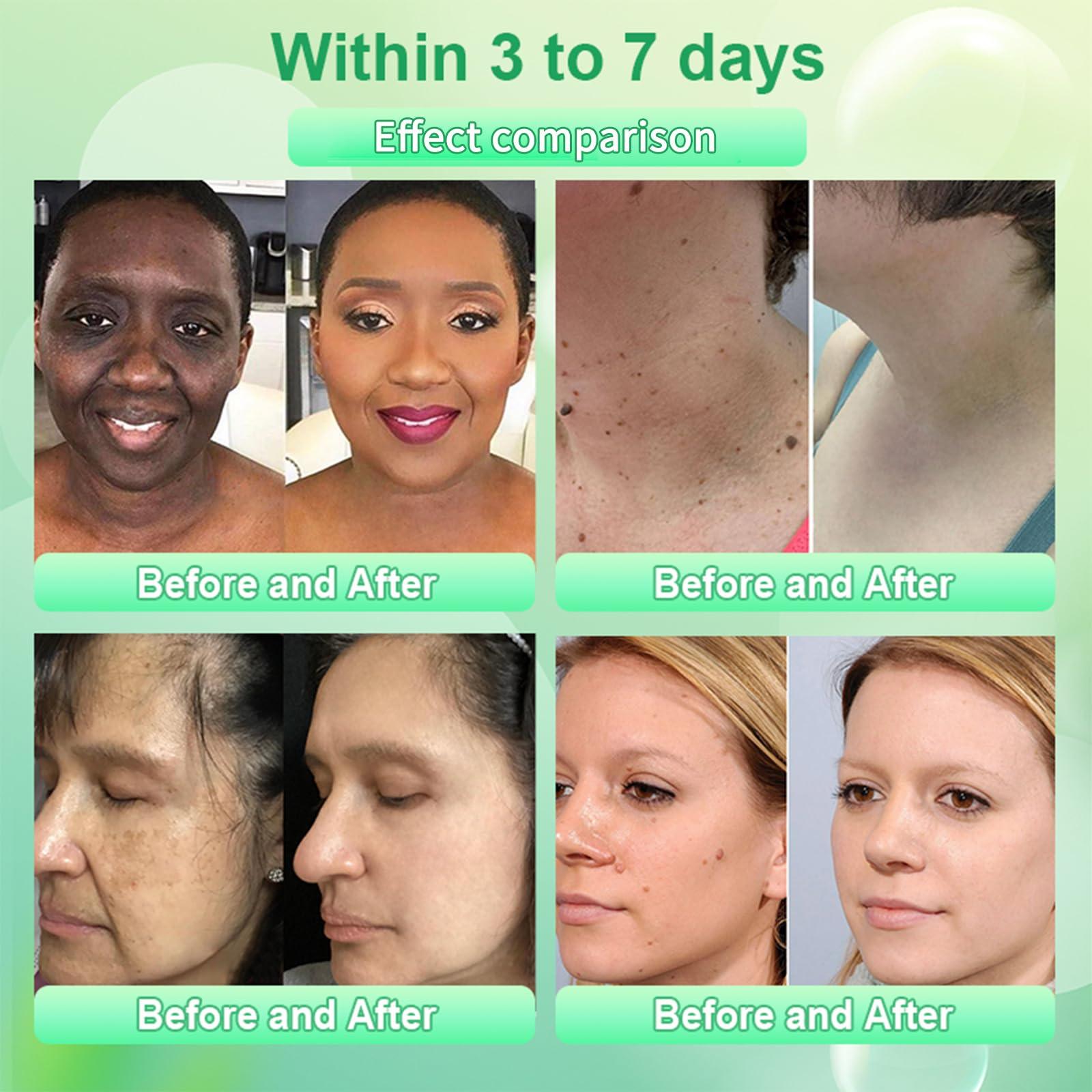 Luhaka JORONDY Purifying Peel Gel, purifying peel, deep cleans and moisturizes the skin, effective exfoliation