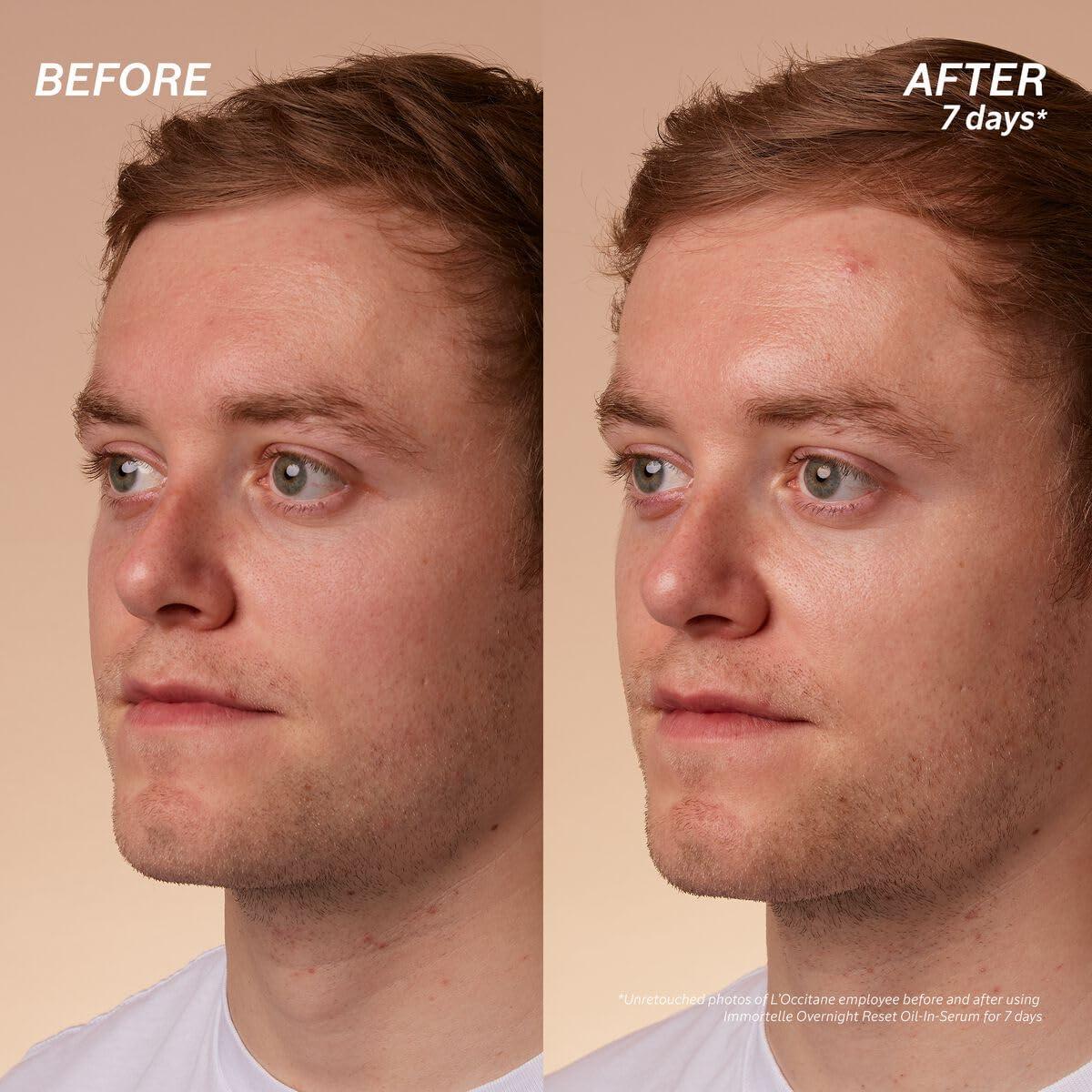 L\'Occitane L\'Occitane Immortelle Overnight Reset Oil-in-Serum 1.60 fl. oz