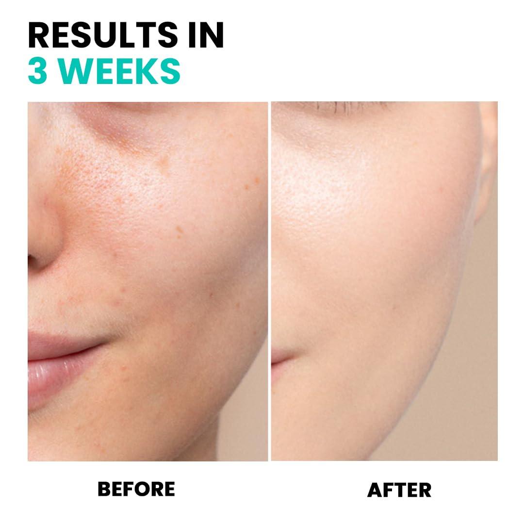 Conatural Conatural Brightening Serum 30ml - Radiant Face Serum, Daily Hydration, Antioxidant-Infused for Luminous Complexion, Water-Based Facial Serum for Radiance