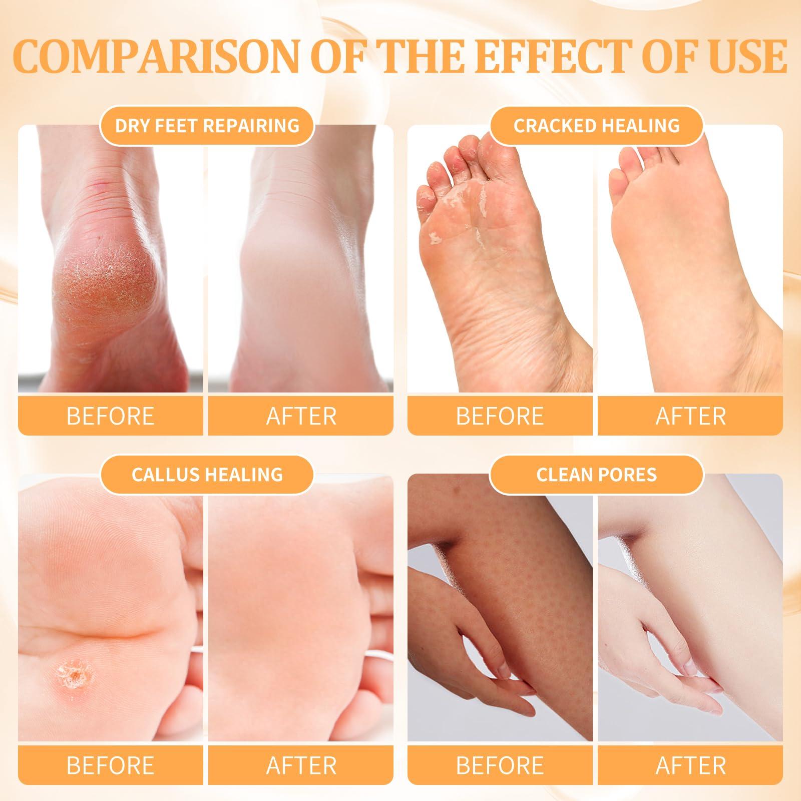 nbc BeautiLab nbc BeautiLab Pedicure Kit Foot Soak Set: Bubble Salt, Sugar Scrub, Massage Mask, Massage Lotion in a Box, 4 Step Foot Spa Kit for Dry Feet, Calluses and Tired Feet(1 Set Tropical Fruit)