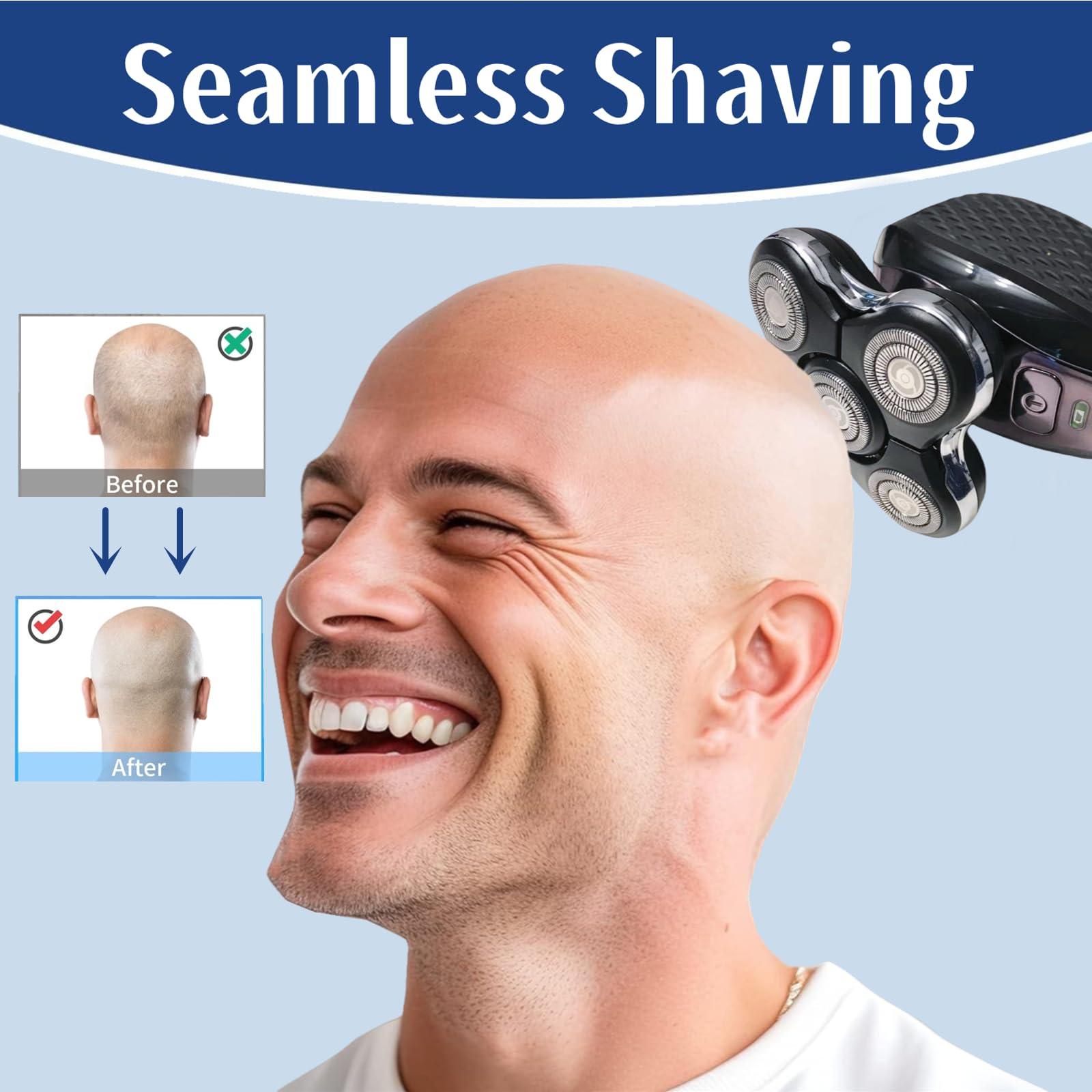 Midnt Balder Pro Replacement Head for Remington Balder Pro Head Shaver SPR XR7000,5 Dual Track Heads for Remington Shaver Replacement Heads-Precision Electric Shaving for Bald Men.(2Pack)