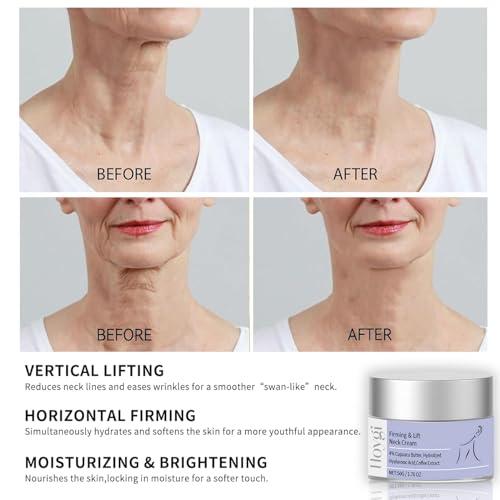 Callmynm Neck Firming Cream, Anti Aging - Smooth & Tight Skin Wrinkles Lift and Firm Neck Cream for Sagging Skin and Neck Moisturizing -1.7 oz