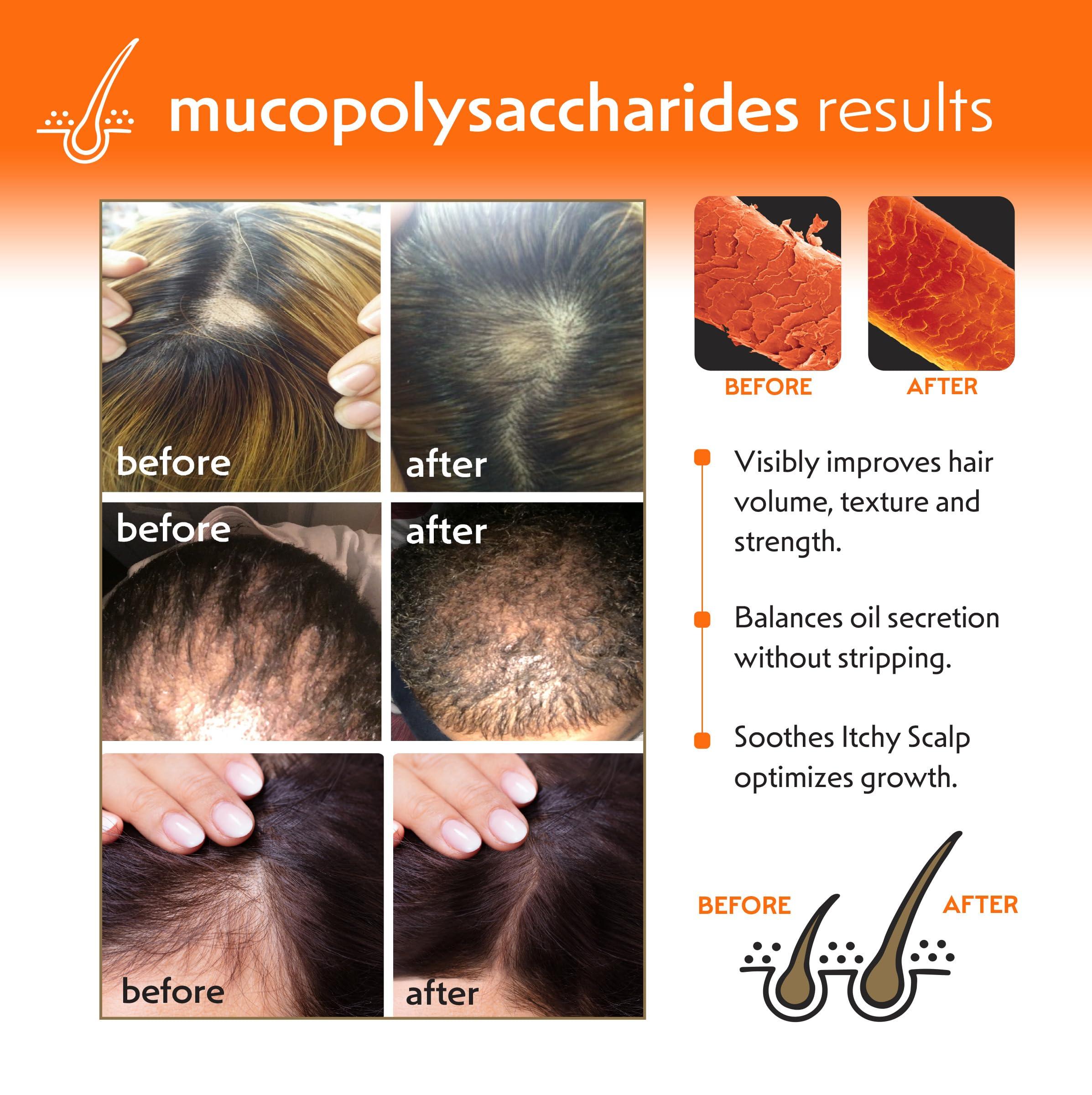 NetWurks Hair & Scalp Regrowth Bundle, Restores Scalp Health & Promotes Hair Growth, Shampoo 8oz & Regrowth Oil 2oz with Biotin, Netwurks