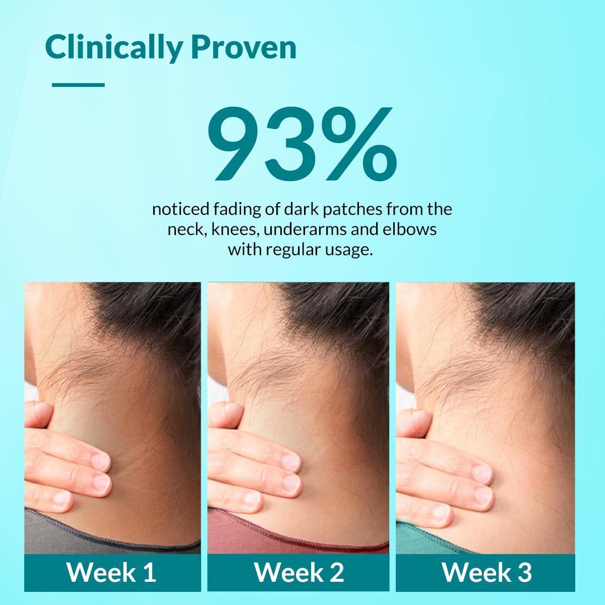 FIXDERMA FIXDERMA Nigrifix Cream for Acanthosis Nigricans with Lactic Acid | Dermatologist Tested Retinol Cream | Useful for Dark Body Parts like Neck, Ankles, Armpits & Elbows 3.38 FlOz