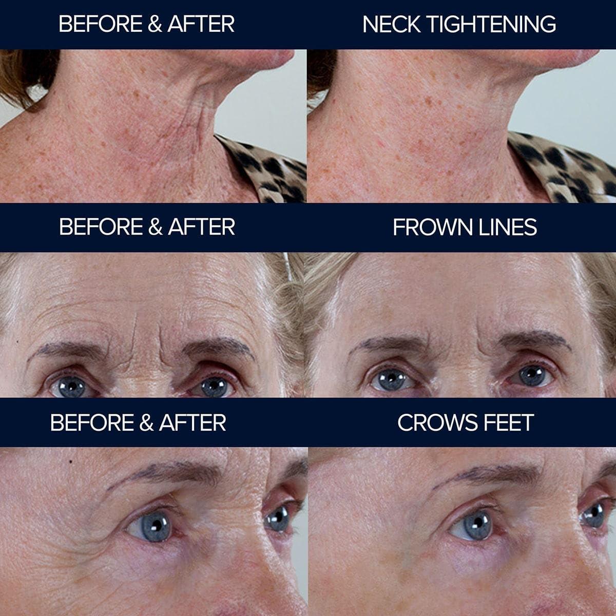 Adonia Organics Peptide10 by Adonia Organics - Instant Wrinkle Concealer - Peptide 10 Instant Anti-Aging Serum