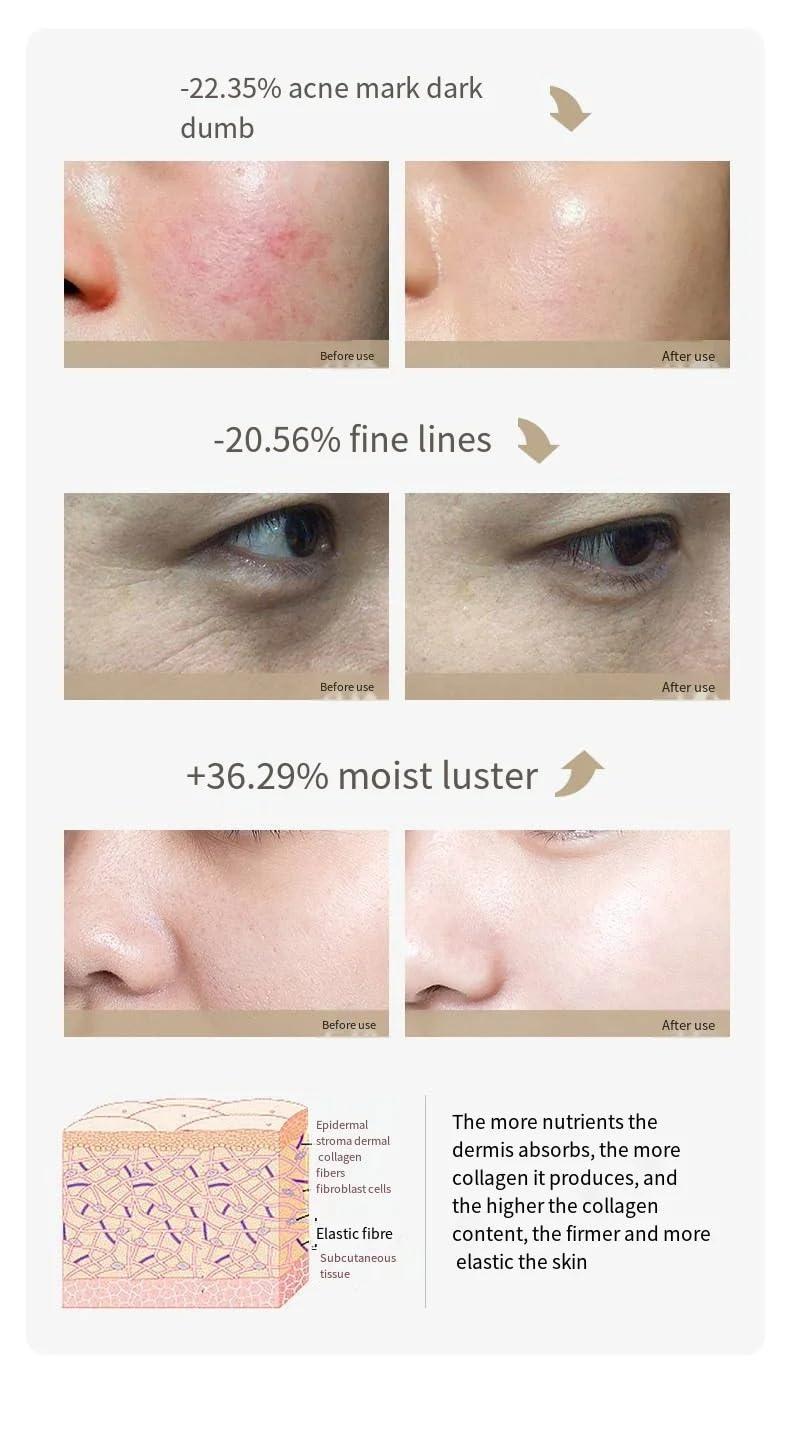 Generic Generic Red Blue Water Light Gun Needle-Free Facial Essence Introduction Instrument Microcrystalline Beauty Tender Skin Instrument, White