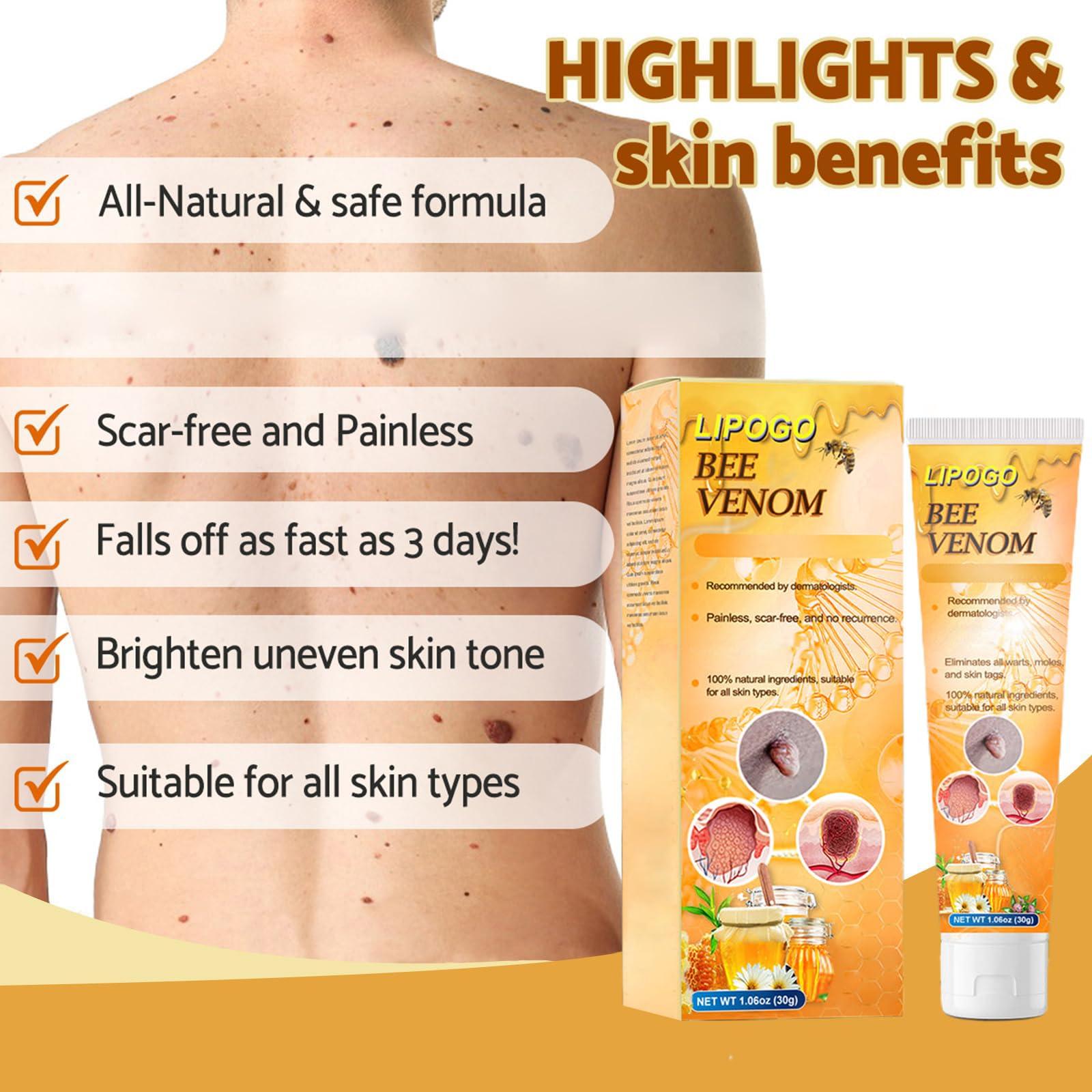 flysmus flysmus LIPOGO Bee Venom Treatment Cream - Professional Bee Venom Repair Cream, Bee Venom Treatment Gel for All Skin Types (4PCS)