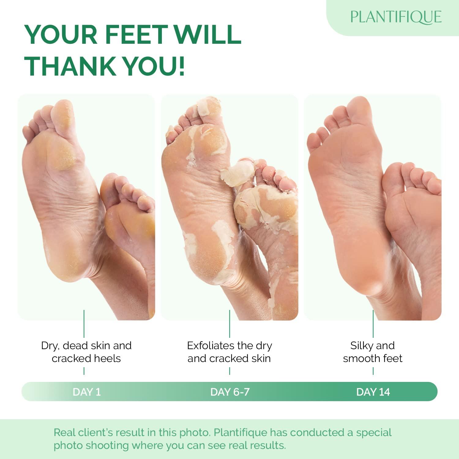 PLANTIFIQUE PLANTIFIQUE Foot Peeling Mask - 4 pack Dermatologically Tested to Repair Heels & Remove Dead Skin for Baby Soft Feet - Exfoliating Peel Mask for Cracked Feet
