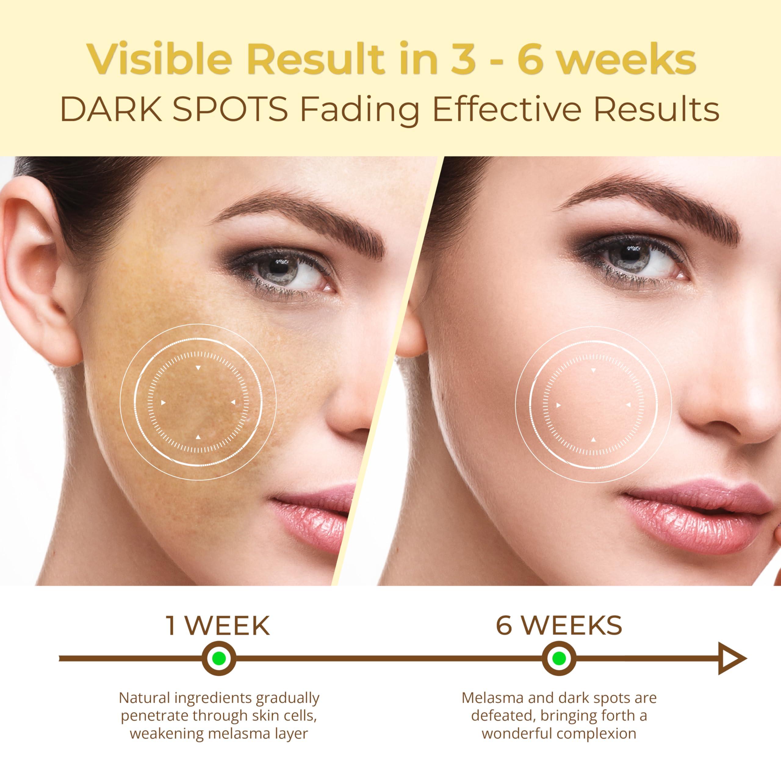 ABERA ABERA Kasumi Moisturizer Cream, Cream for Hydrating to Plump and Repair Dry Skin, Safe for Sensitive Skin (3 Boxes)