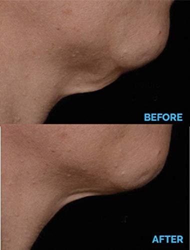 AminoGenesis AminoGenesis N.E.C.K Control: Neck Lifting, Firming And Retracting Cream