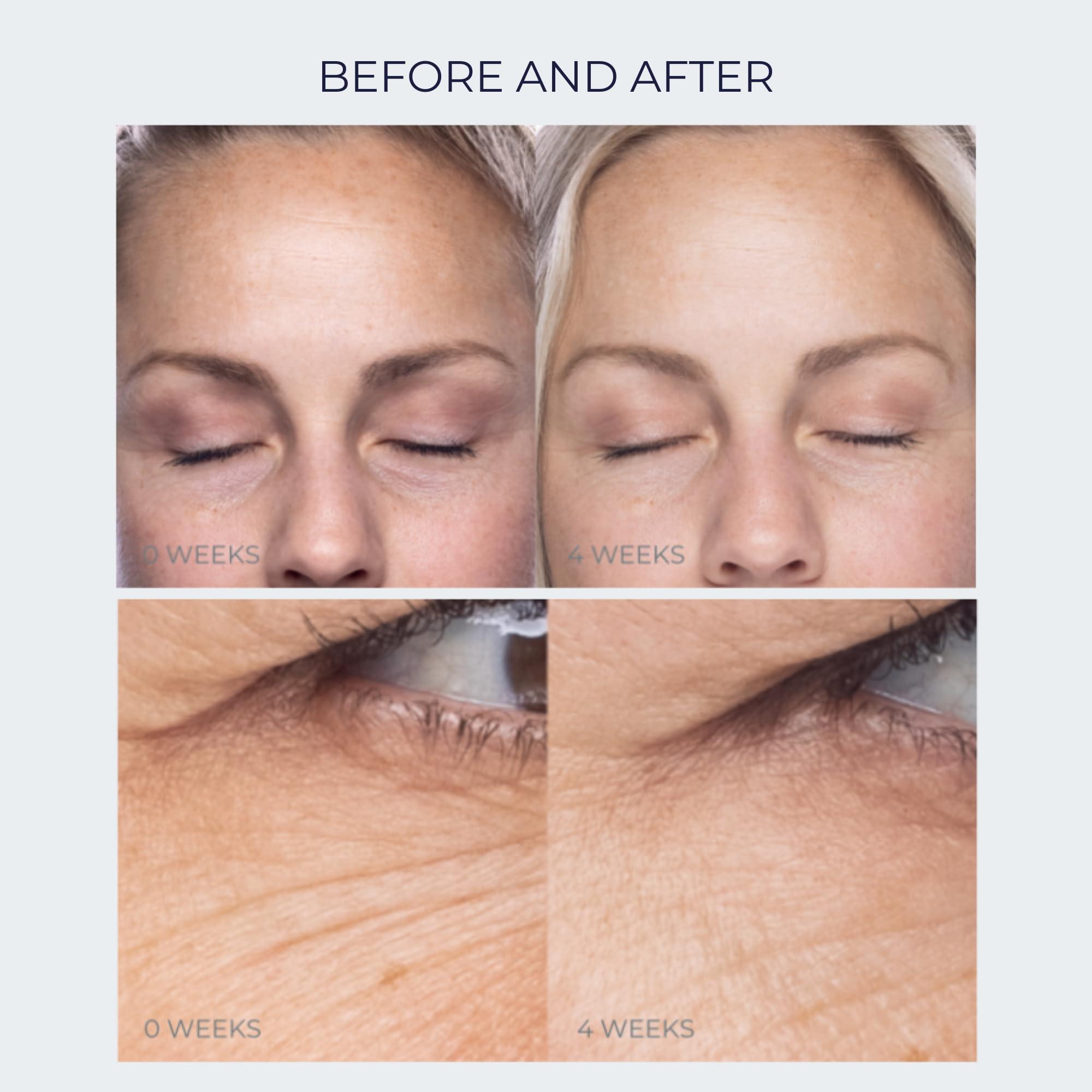 Alana Mitchell Anti-Aging Peptide Under Eye Cream Peptide Eye Cream for Hydrated & Firm Skin Under Eye Cream for Dark Circles and Puffiness Anti Aging Eye Cream for Crows Feet & Fine Lines (0.5 oz/15 ml)