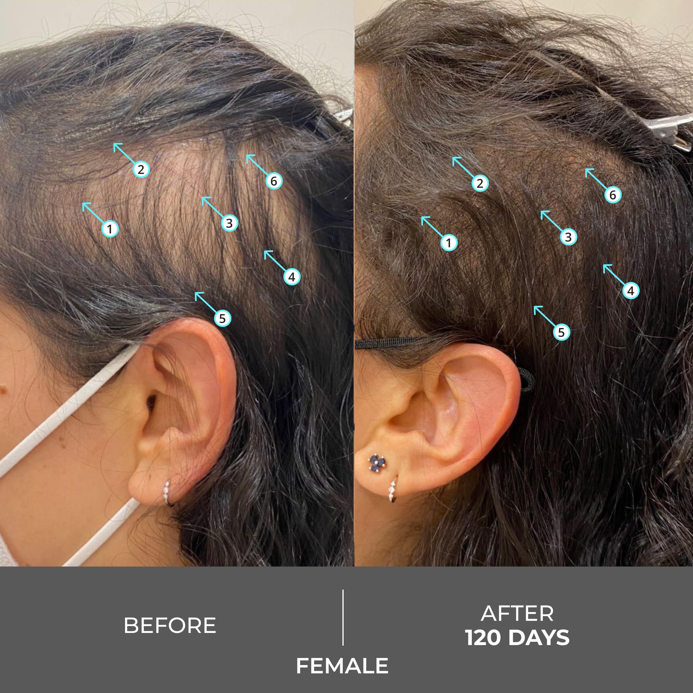 DS Laboratories DS Labs Revita Extra Strength Shampoo & Tablets Kit - High-Performance Hair Density, Volumizing & Thickening, Fuller Looking Hair, Saw Palmetto, for Men & Women