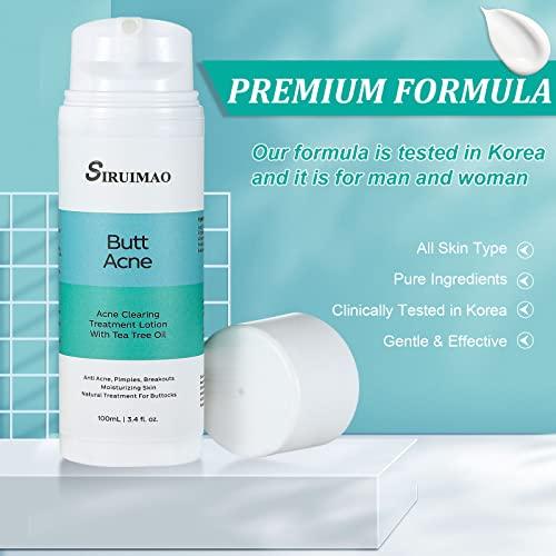 SIRUIMAO SIRUIMAO Butt Acne Clearing Treatment (3.5OZ), Bum Acne Treatment for Clearing Acne, Pimples, Blackheads, Zits and Razor Bumps for the Buttocks and Thigh Area (2 bottles)