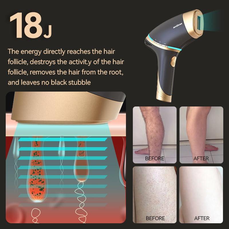 icelady icelady Cooling Hair Removal Device, Hair Removal for Women and Men, Painless Permanent Hair Removal System on Full Body, Black
