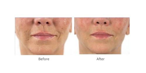 Dr.Sevinor Skincare Solutions Dr Sevinor Wrinkle Solution Smoothing Tinted Serum and Dr. Sevinor\'s Facelift Solution Concentrated Serum Revitalizes Tired Looking Skin, Diminishes Wrinkles/Lines. Combo Special SAVE 10%