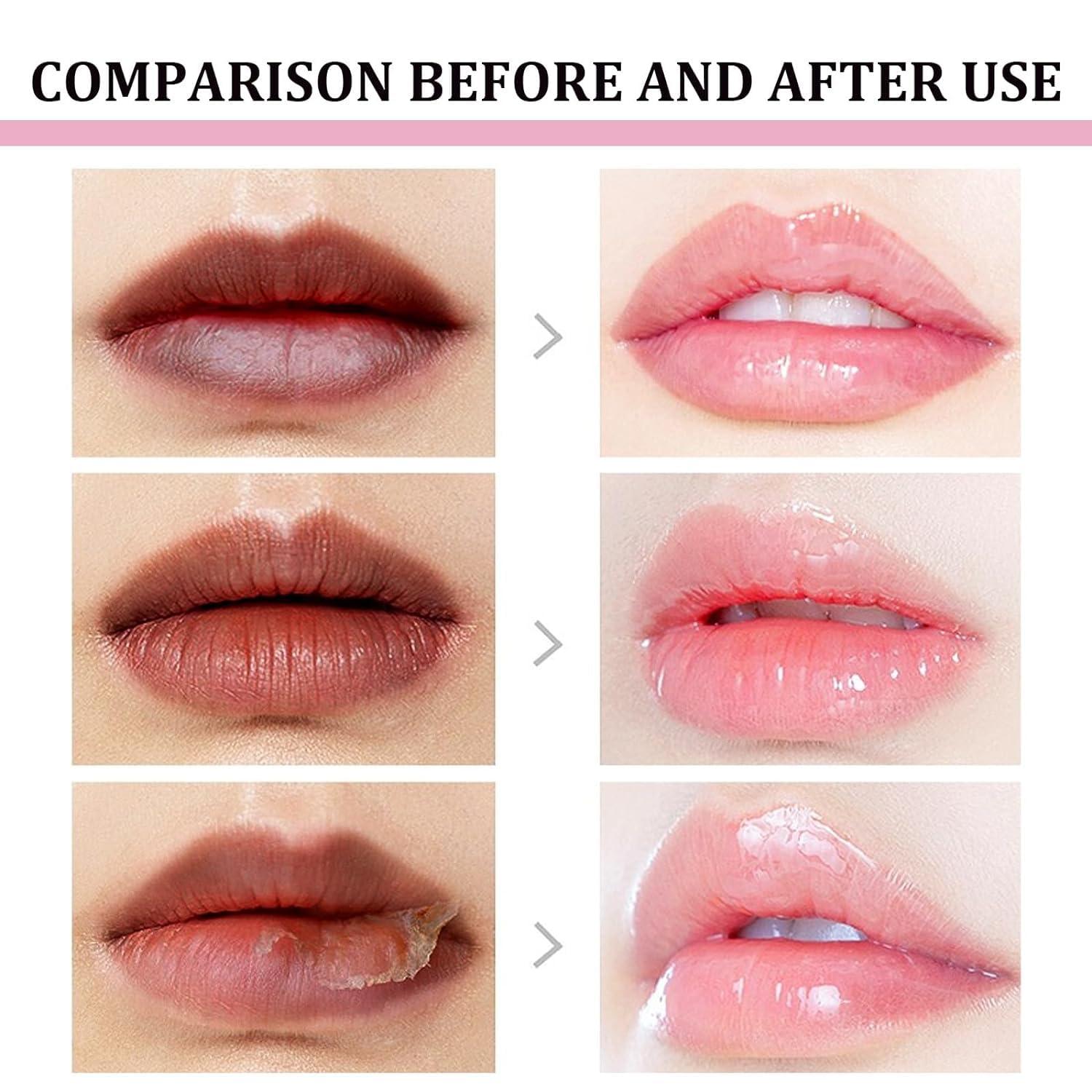 MeXmoB 2pcs Lip Lightening for Dark Lips Lip for Smokers Dark Lip Treatment Lightening Cream for Pink Lips Lip Lightener for Smoker Lips Lip Lightening balm for Men and Women (Orange)