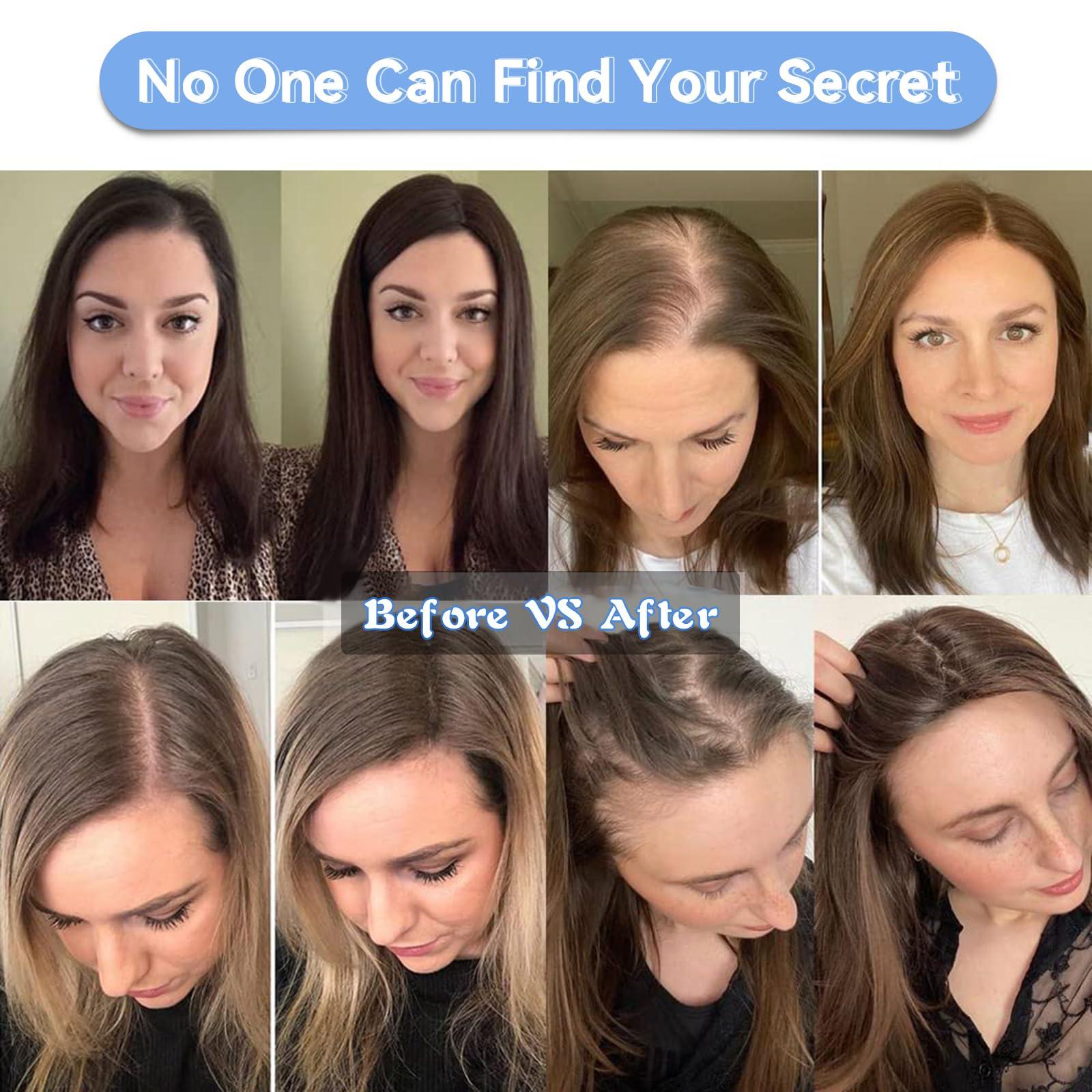 EMMOR EMMOR Hair Topper For Women, 100% Remy Human Hair For Women With Thinning, Hair Loss Cover Gray Hair, Three Clips on Topper, 3.5in4in Hand-Tied, 12 inch - Ombre Light Blonde