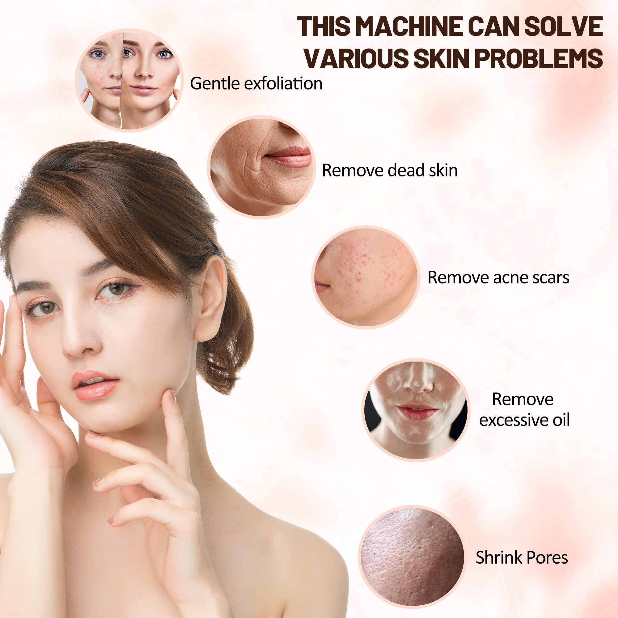 Beauty Star 2 IN 1 Diamond Microdermabrasion Machine, BEAUTY STAR Professional Micro Dermabrasion Machines at Home , Esthetician Supplies Beauty Device for Face Peeling & Cleansing, Suction Power: 0-65cmHg