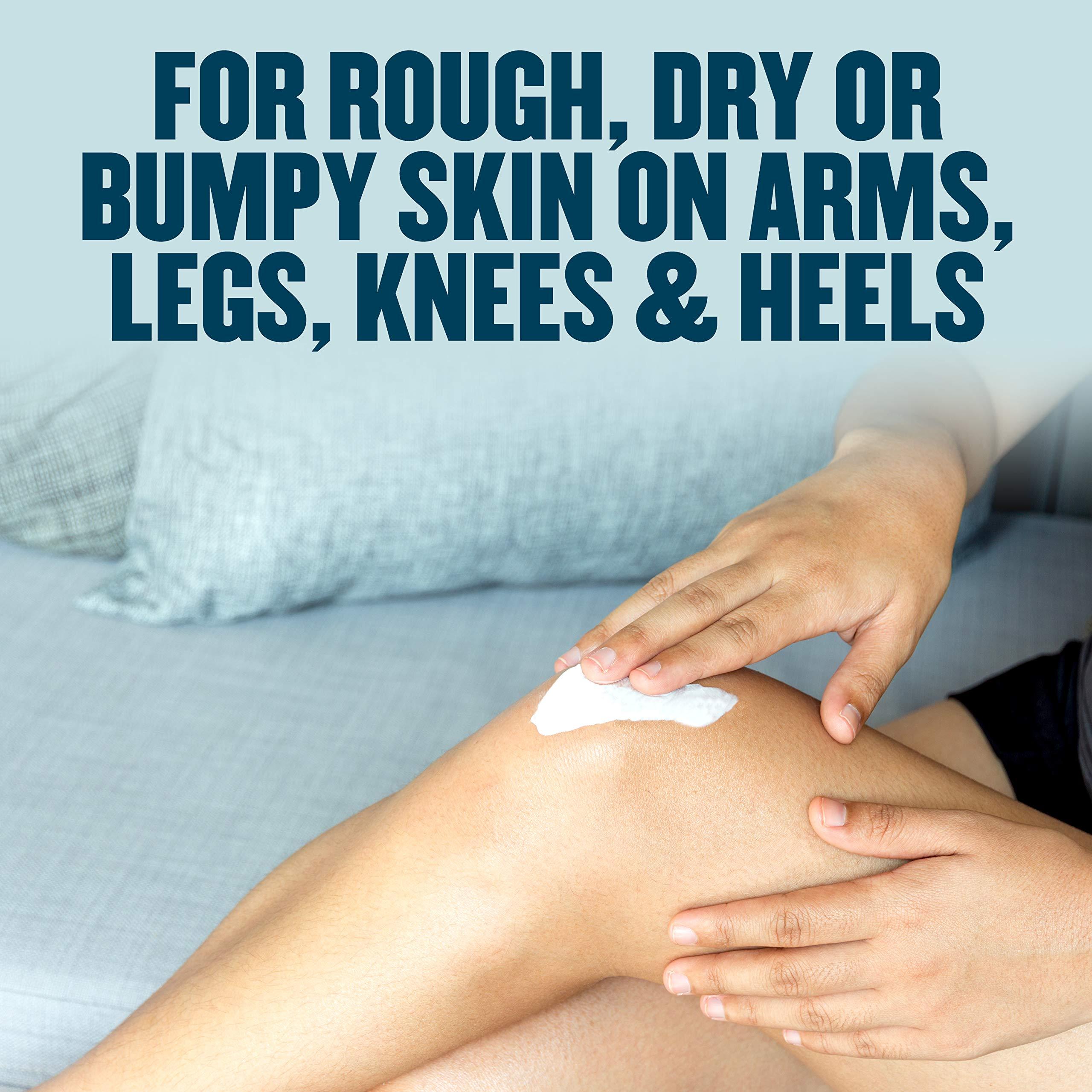 Gold Bond Gold Bond Rough & Bumpy Skin Cream 8 oz., Daily Therapy Cream With 8 Intensive Moisturizes