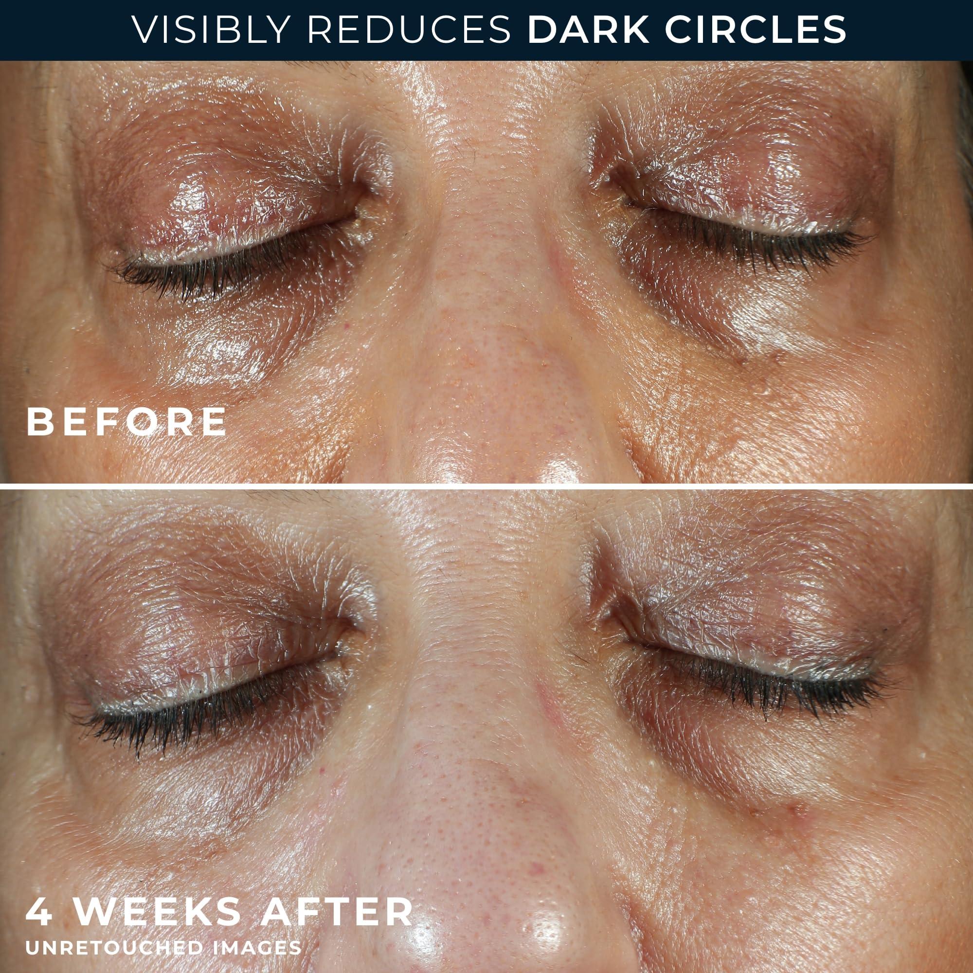 RoC RoC Multi Correxion 5 in 1 Anti-Aging Eye Cream for Puffiness, Under Eye Bags & Dark Circles, Skin Care Treatment with Shea Butter, (.5 oz) with Night Cream Packette (Packaging May Vary)